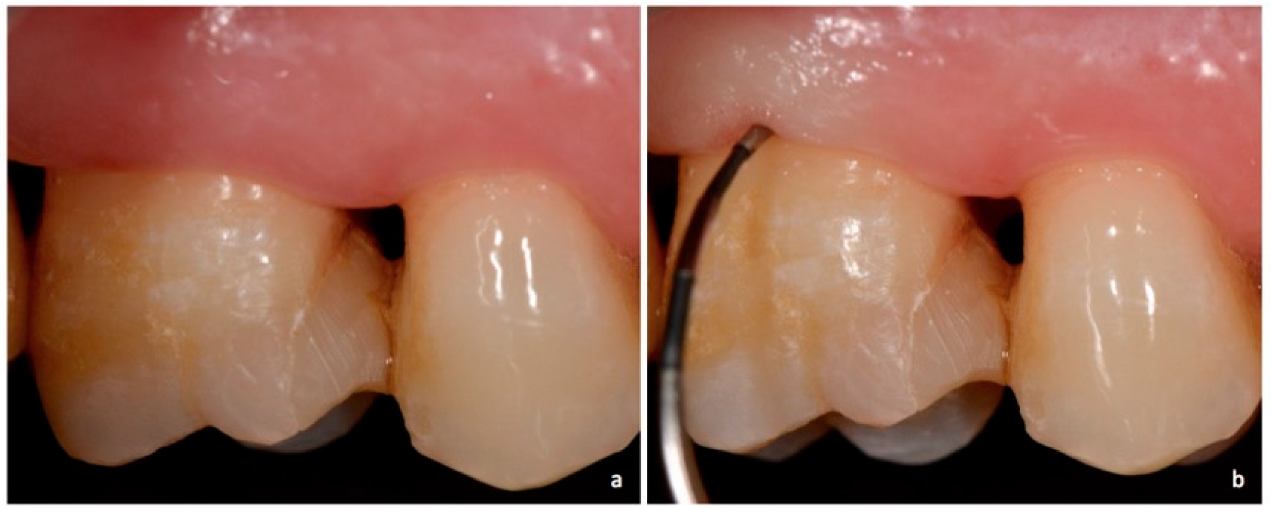 Dentistry 06 00034 g002 Dentistry 06 00034 g002