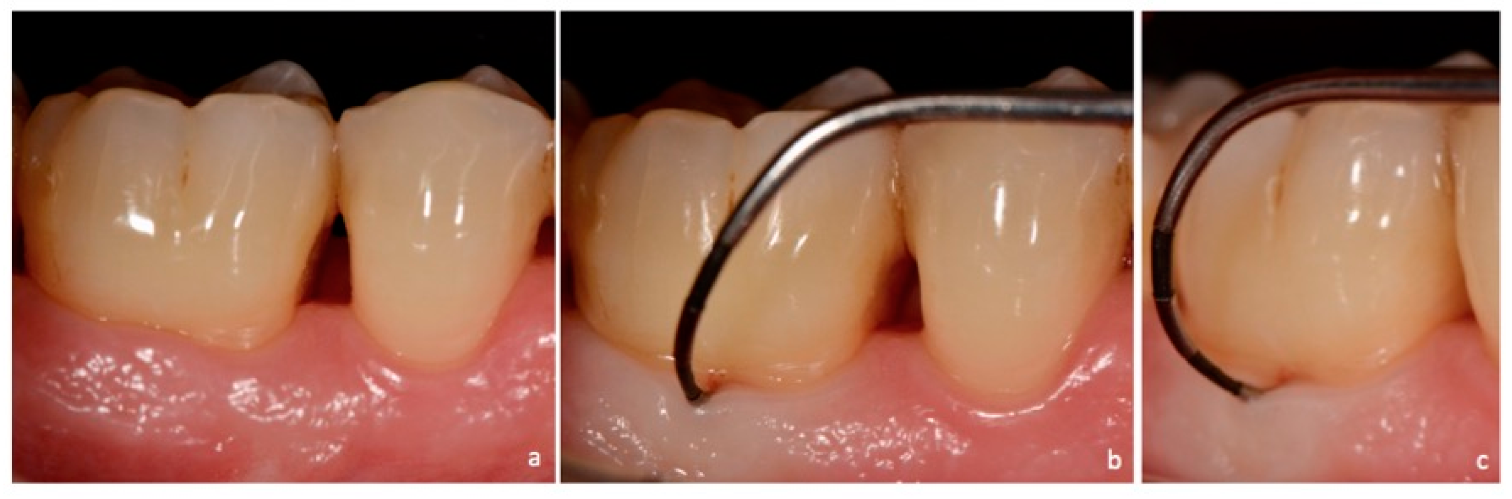 Dentistry 06 00034 g003 Dentistry 06 00034 g003