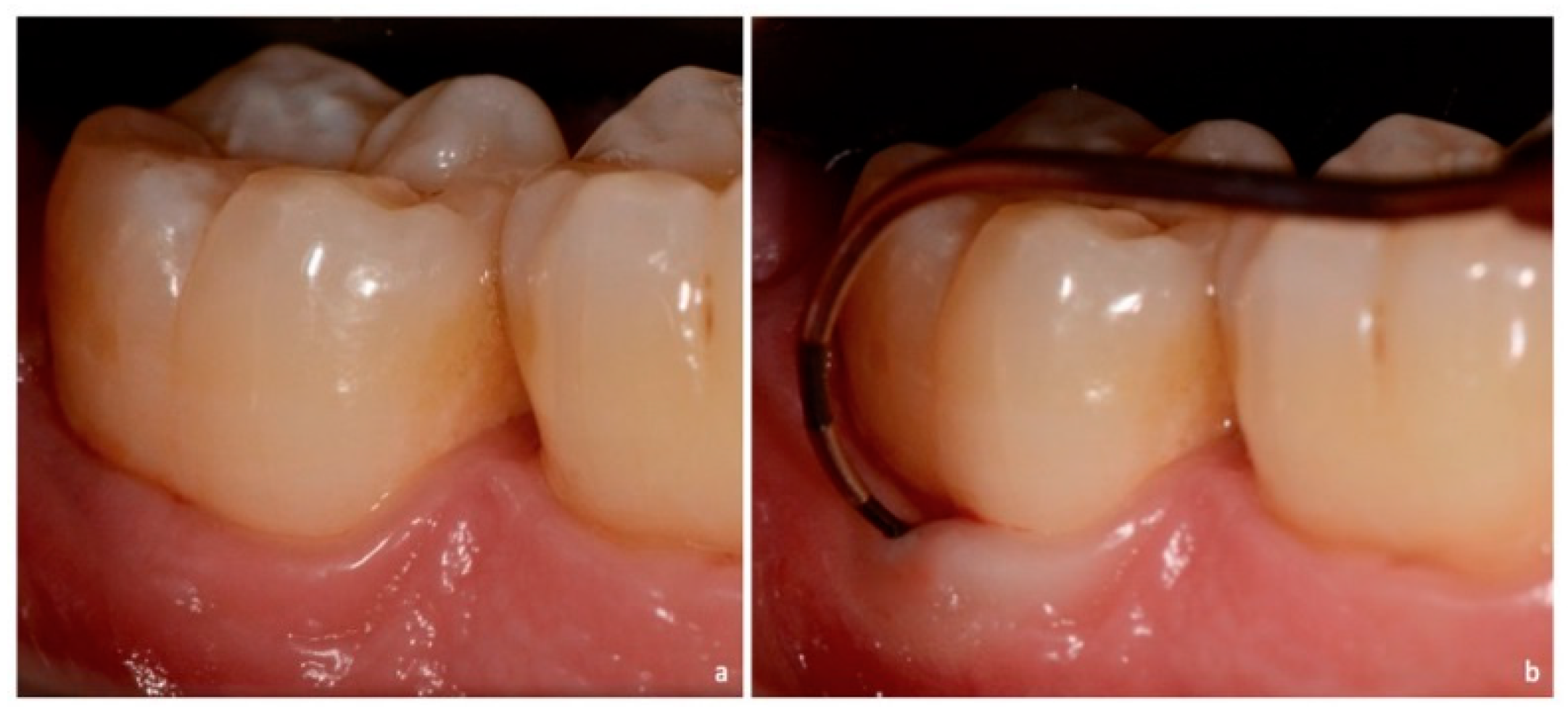 Dentistry 06 00034 g004 Dentistry 06 00034 g004