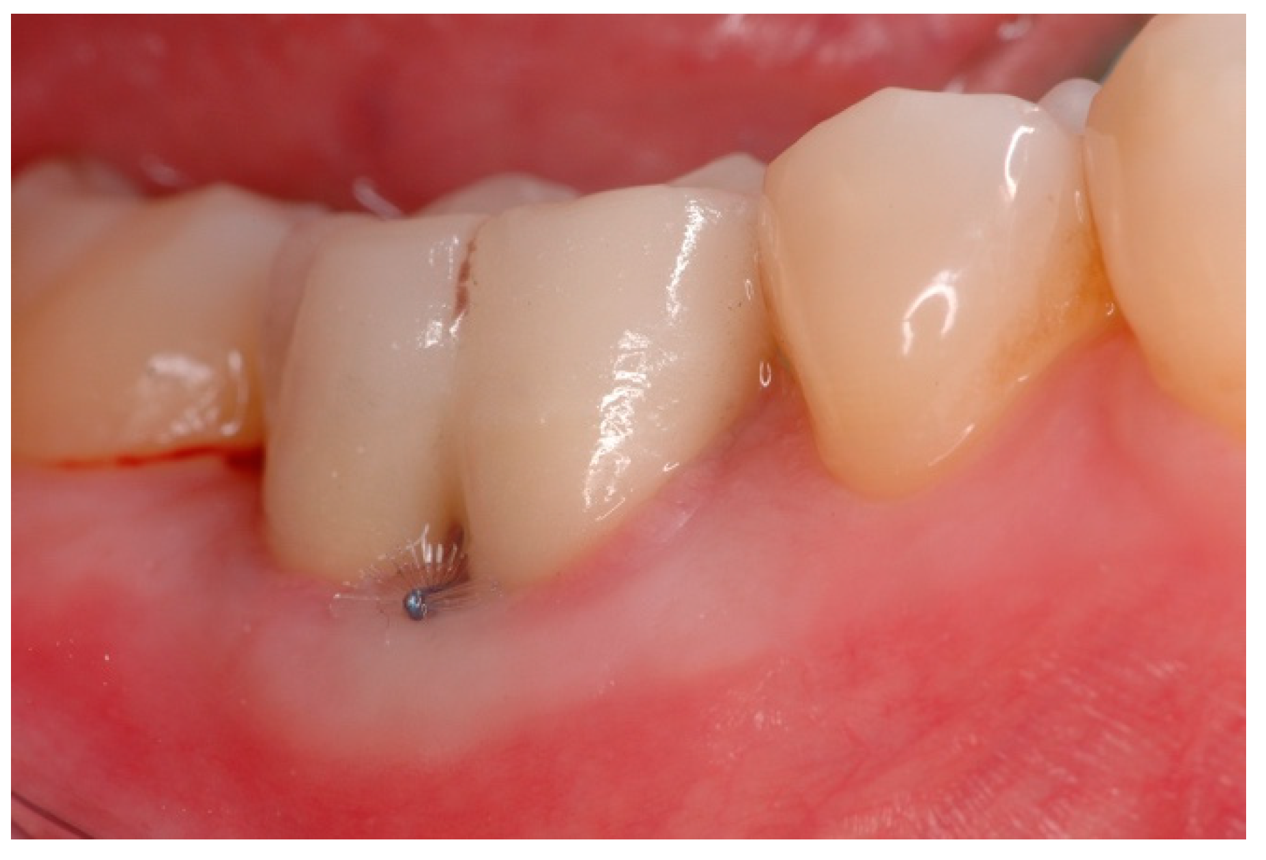 Dentistry 06 00034 g005 Dentistry 06 00034 g005