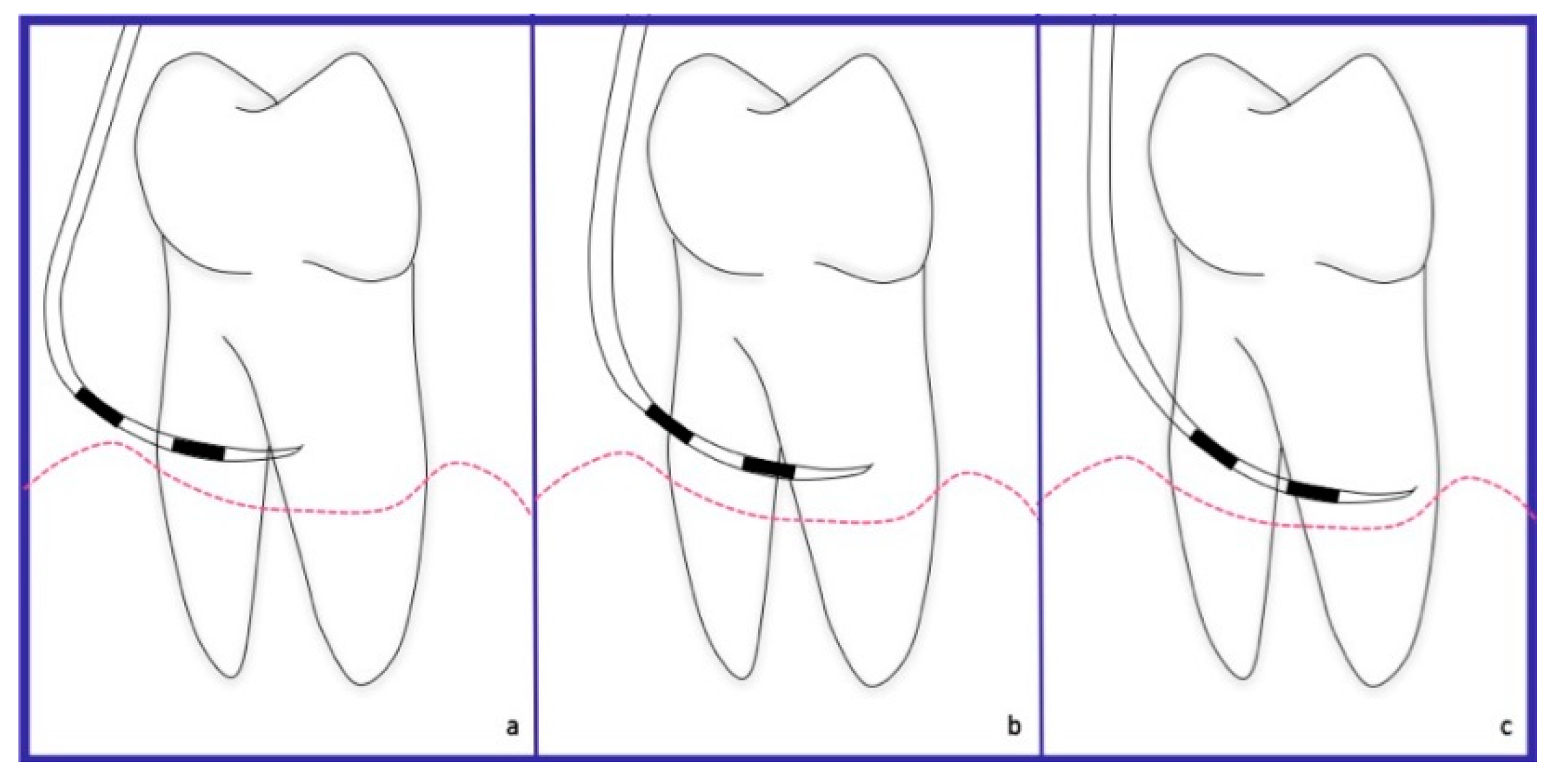 Dentistry 06 00034 g006 Dentistry 06 00034 g006