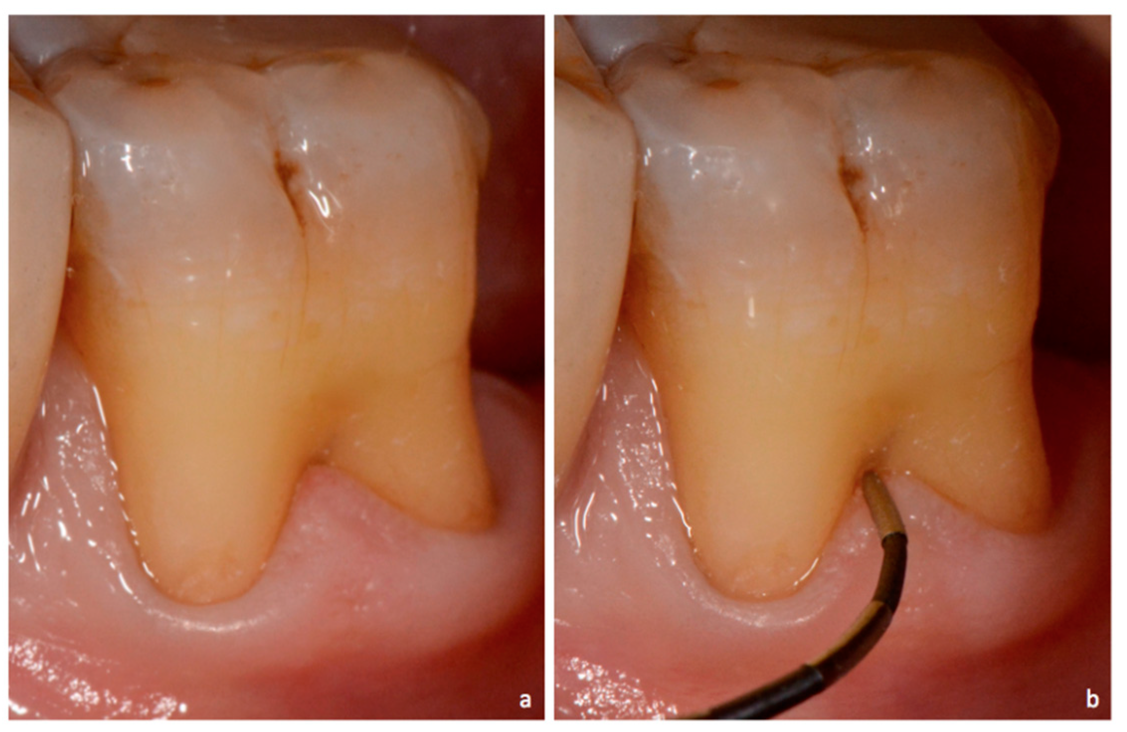 Dentistry 06 00034 g007 Dentistry 06 00034 g007