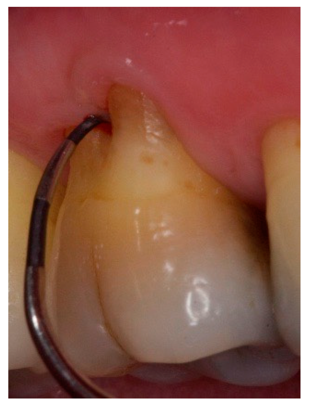 Dentistry 06 00034 g008 Dentistry 06 00034 g008