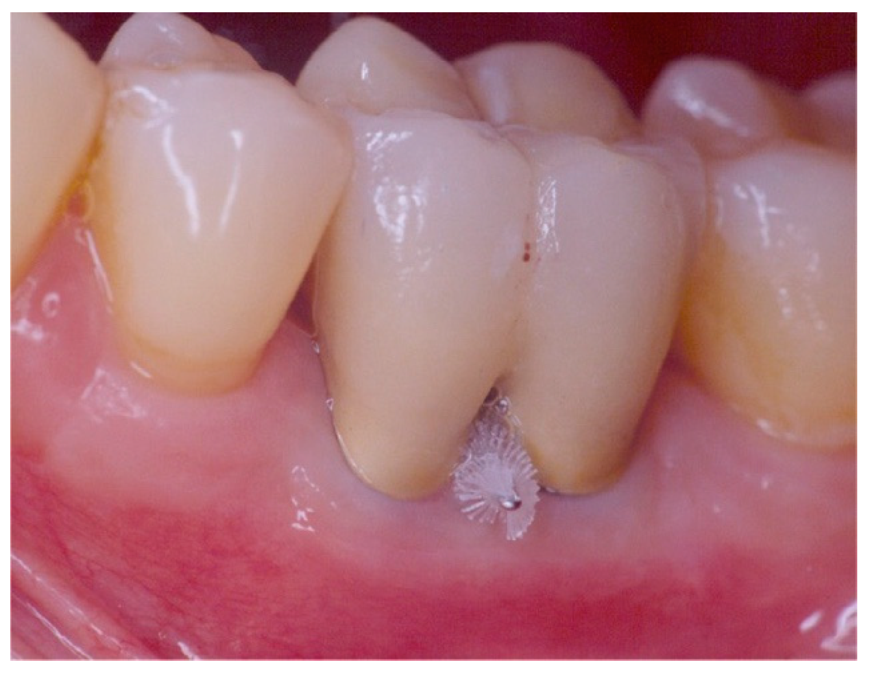 Dentistry 06 00034 g009 Dentistry 06 00034 g009