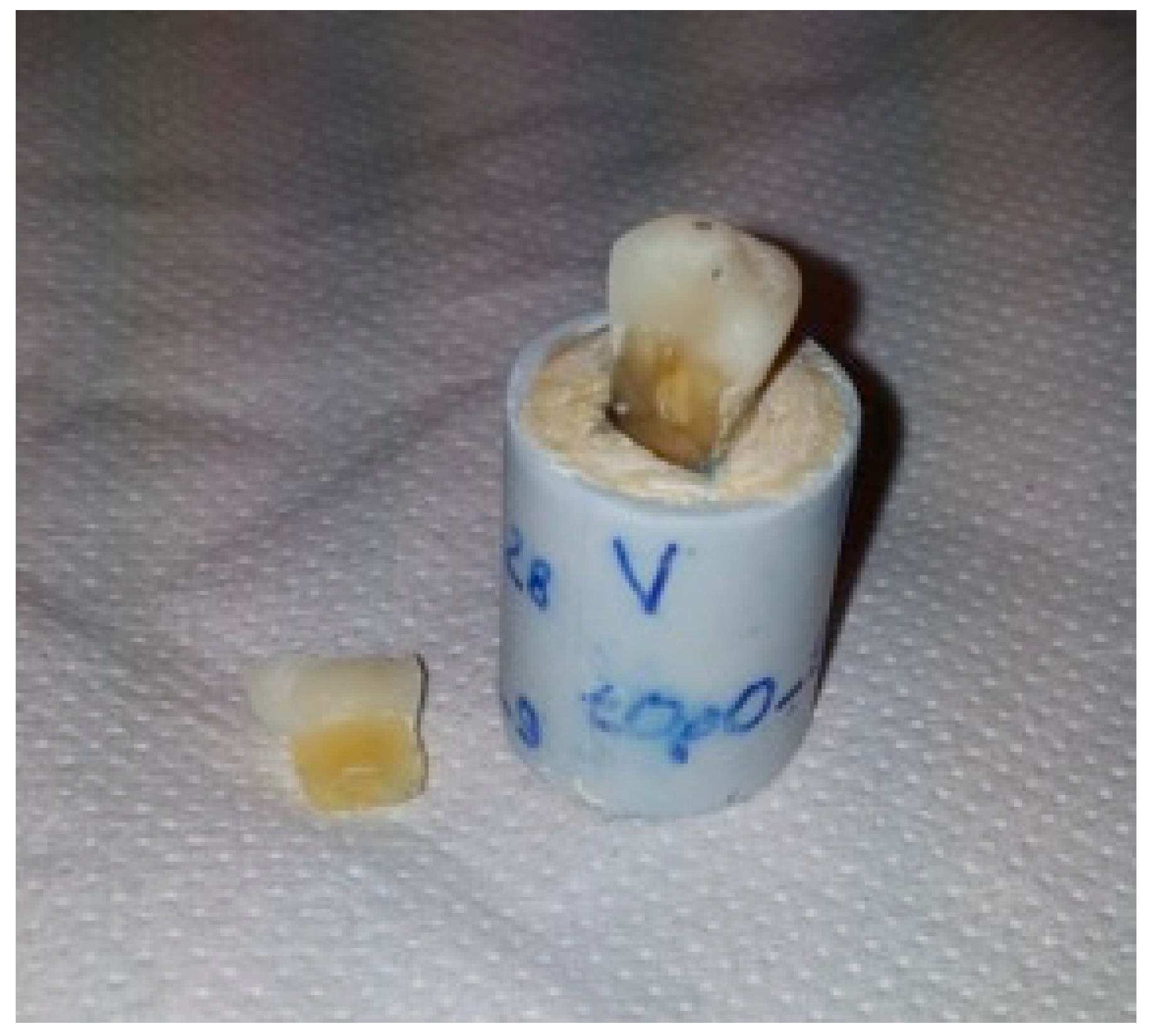 Dentistry 06 00035 g003