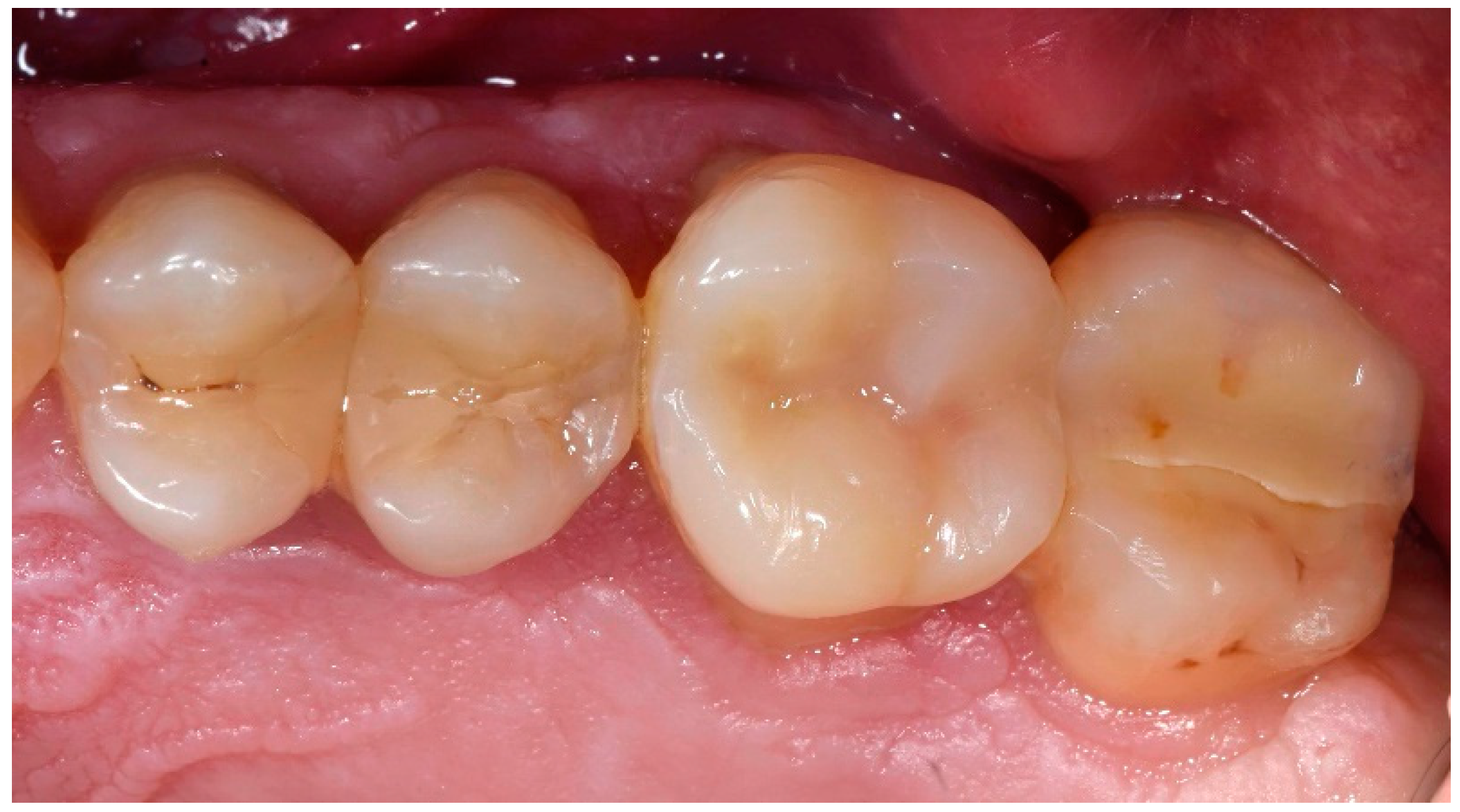 Dentistry 06 00035 g007