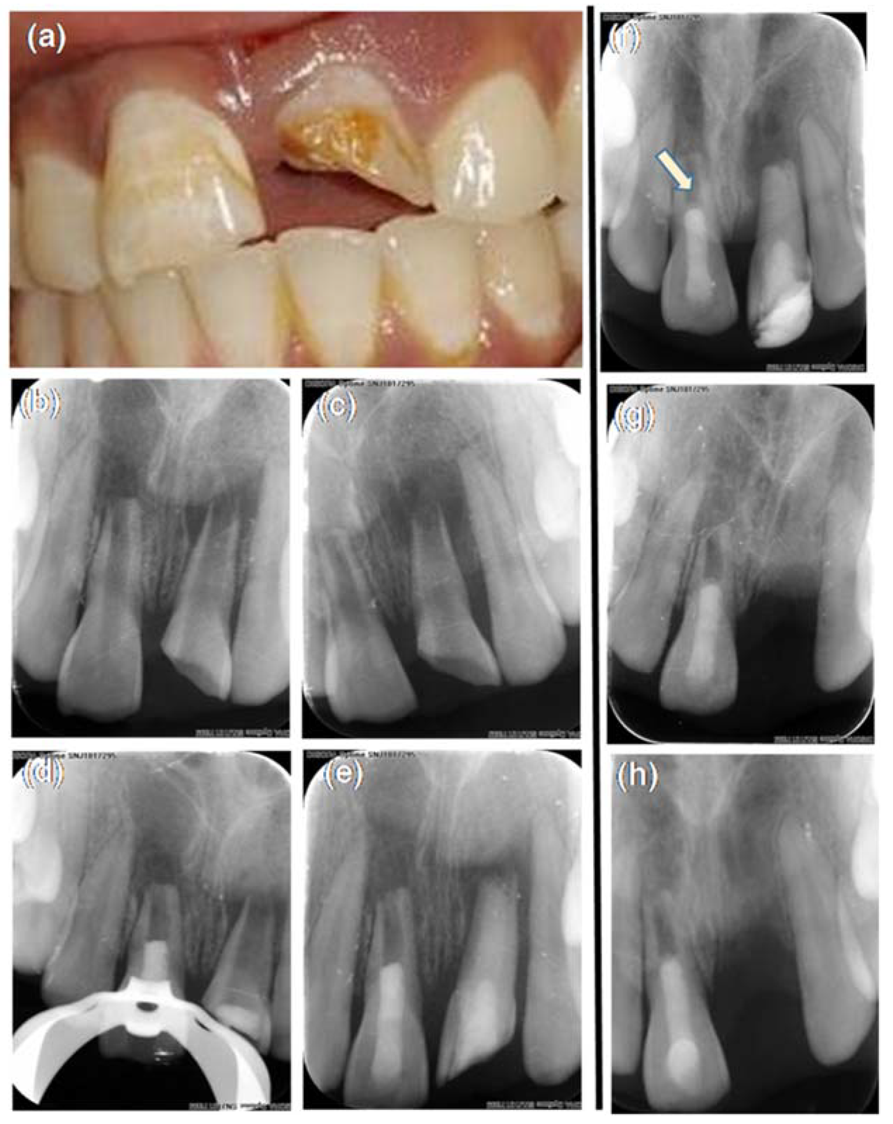 Dentistry 06 00036 g001