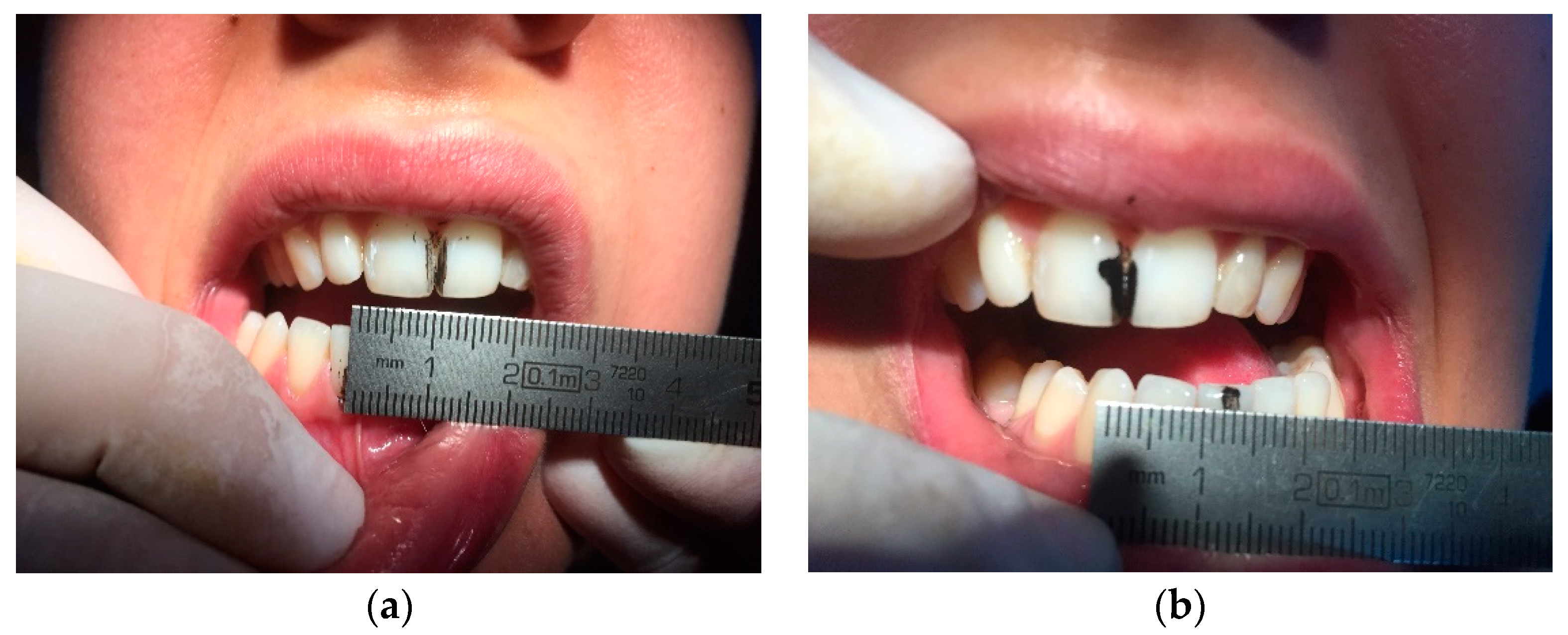 Dentistry 06 00041 g002