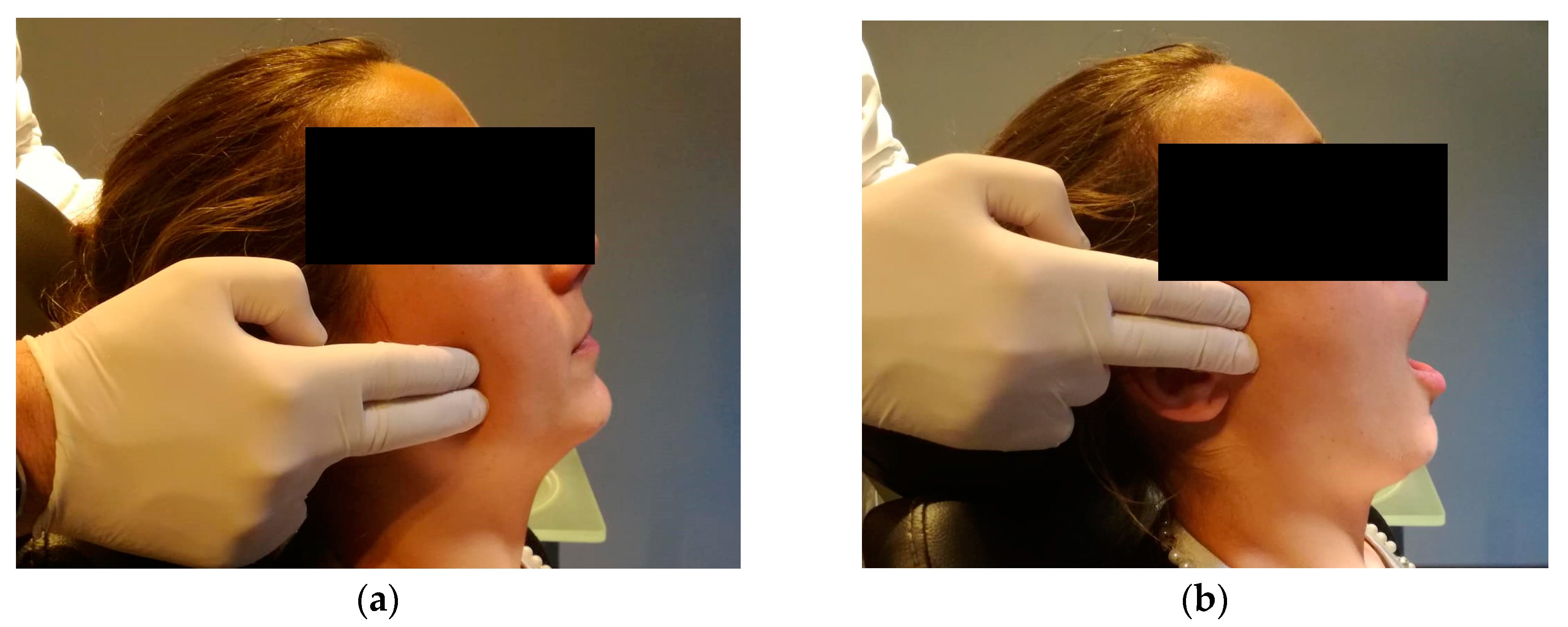 Dentistry 06 00041 g004