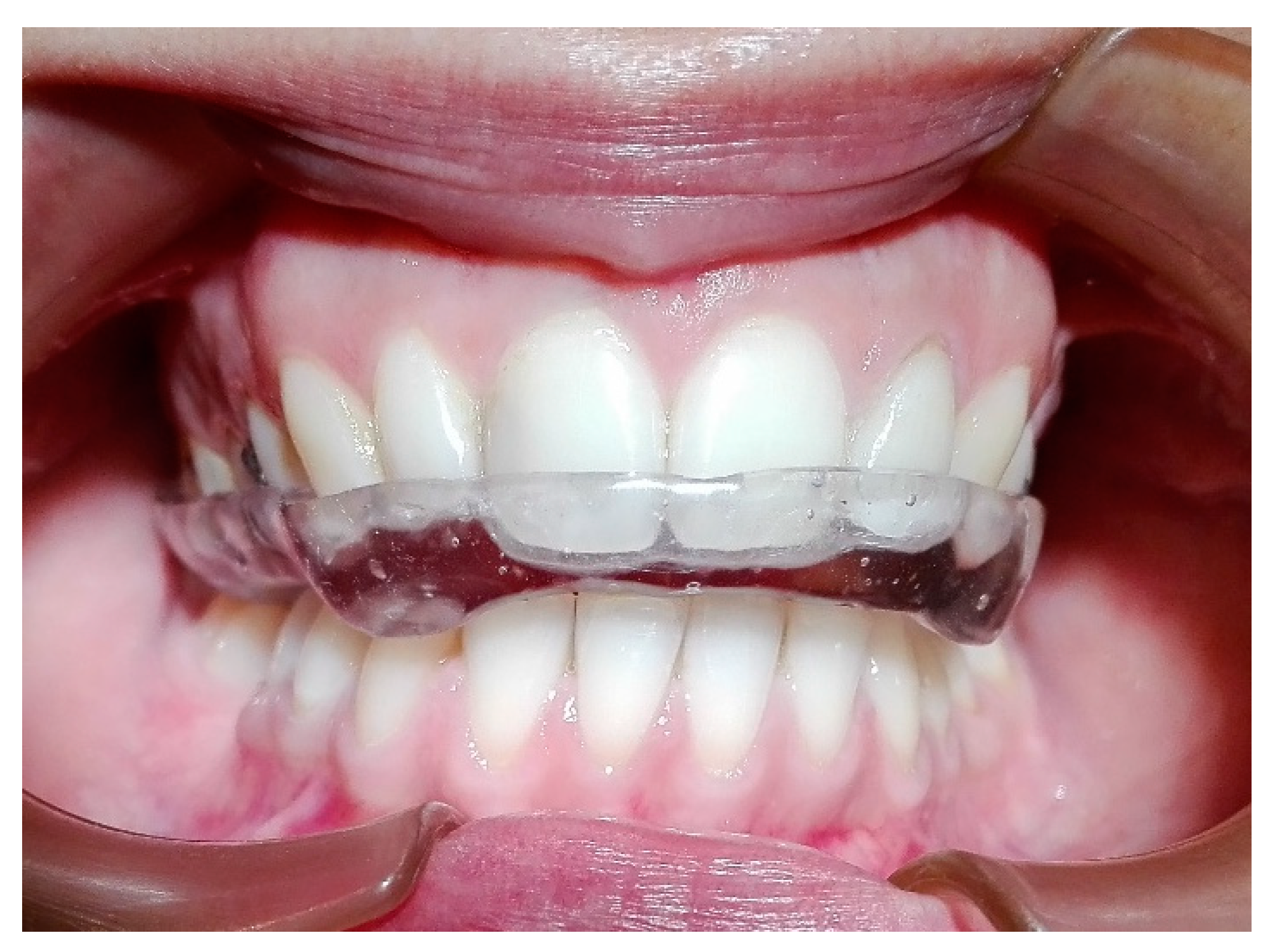 Dentistry 06 00041 g006