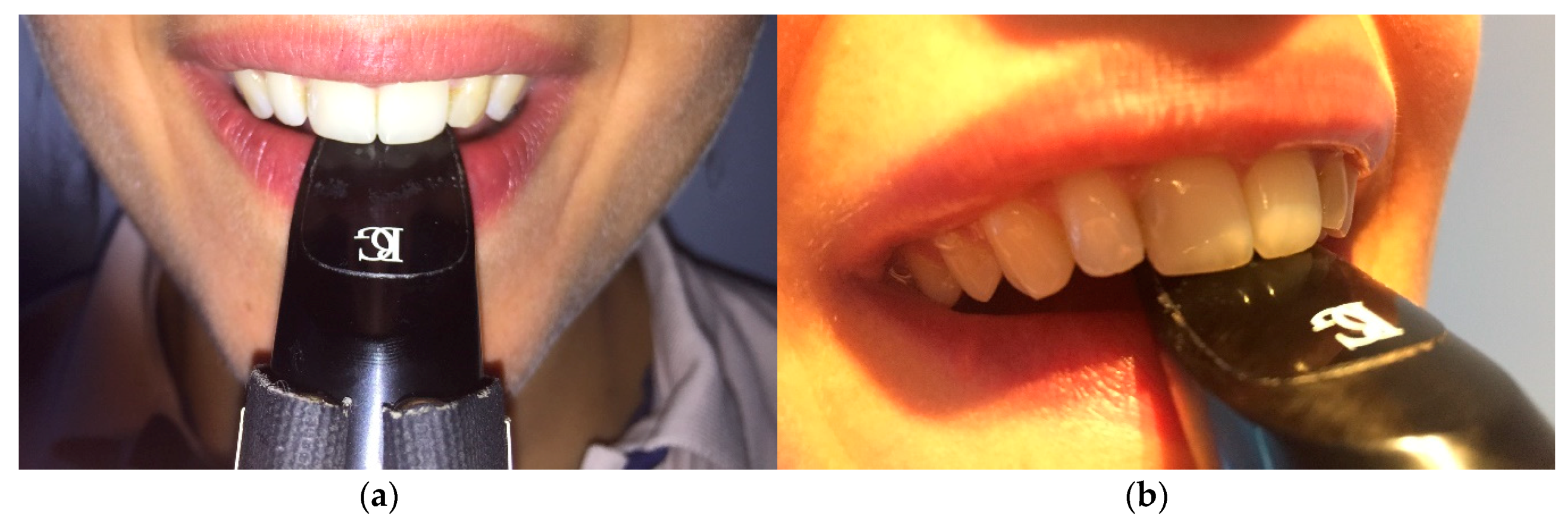 Dentistry 06 00041 g007