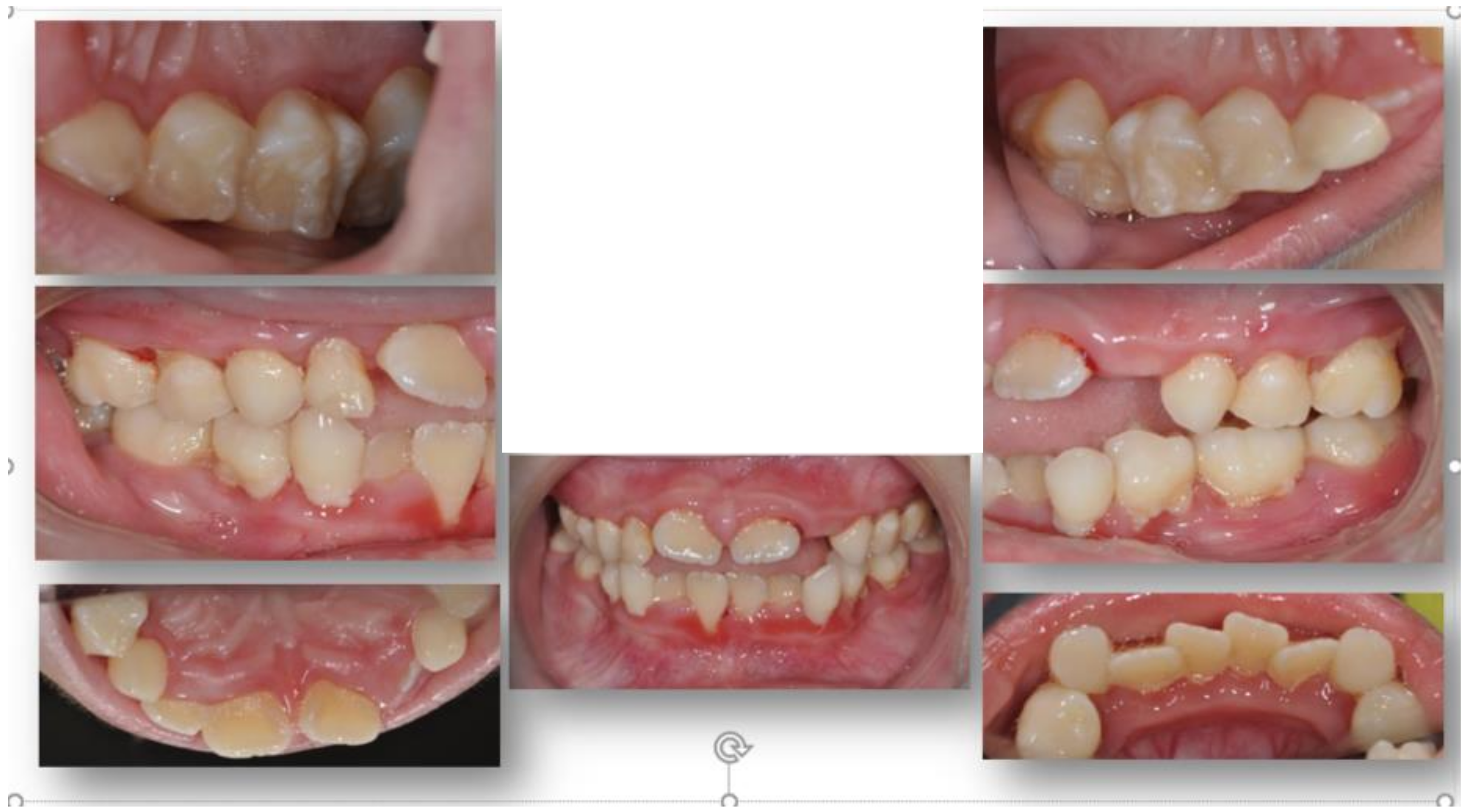 Dentistry 06 00053 g001 Dentistry 06 00053 g001