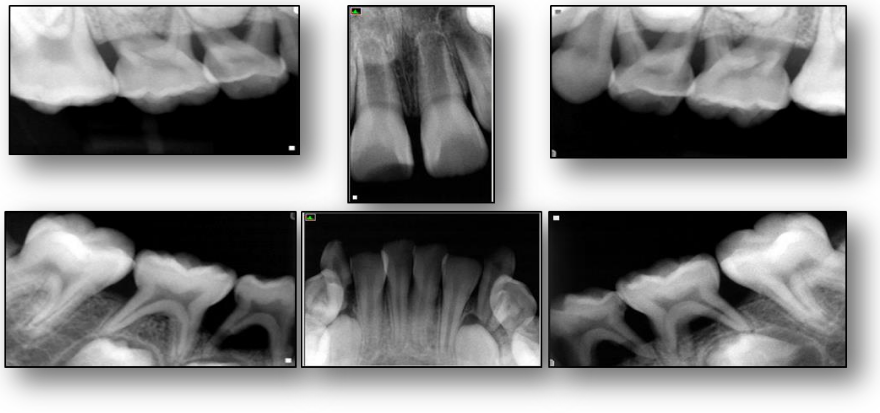 Dentistry 06 00053 g002 Dentistry 06 00053 g002