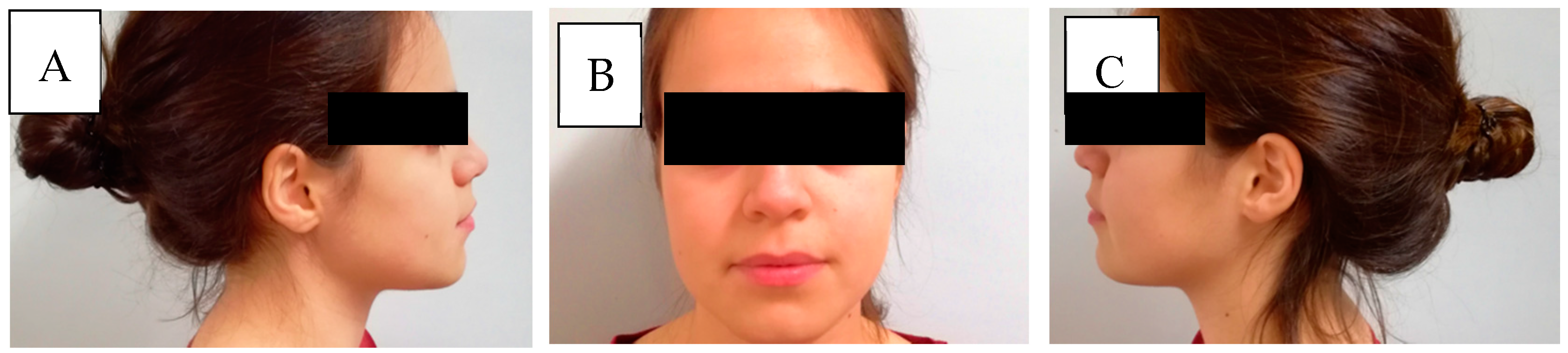 Dentistry 06 00062 g001