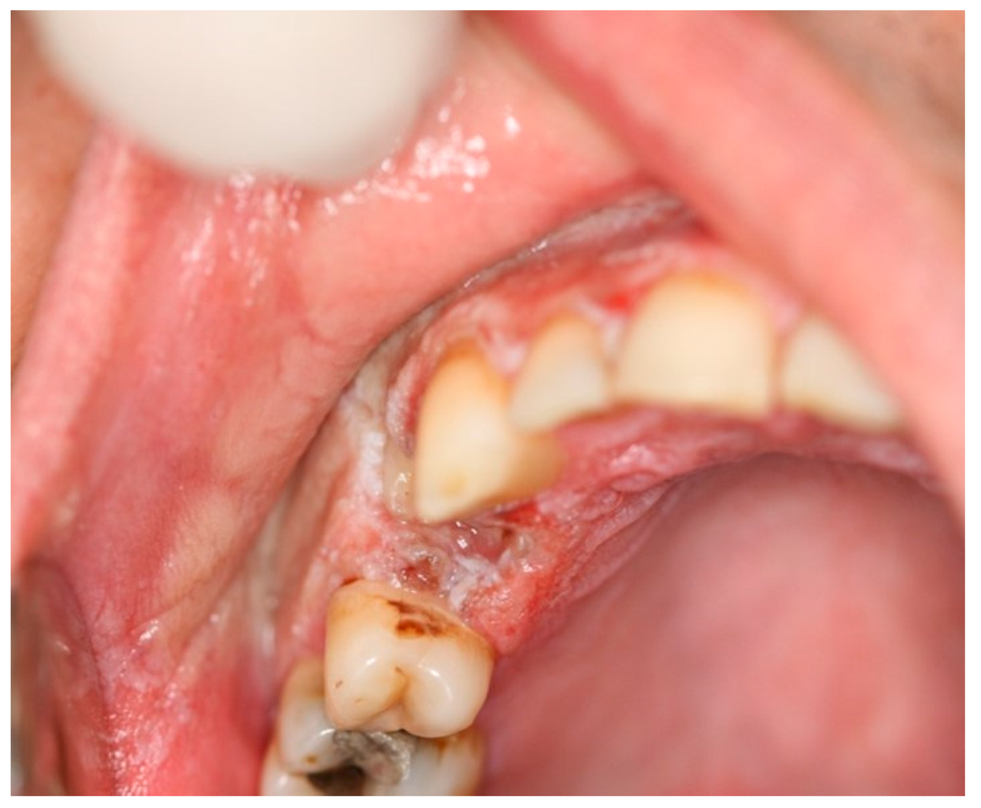 Dentistry 07 00015 g003 Dentistry 07 00015 g003