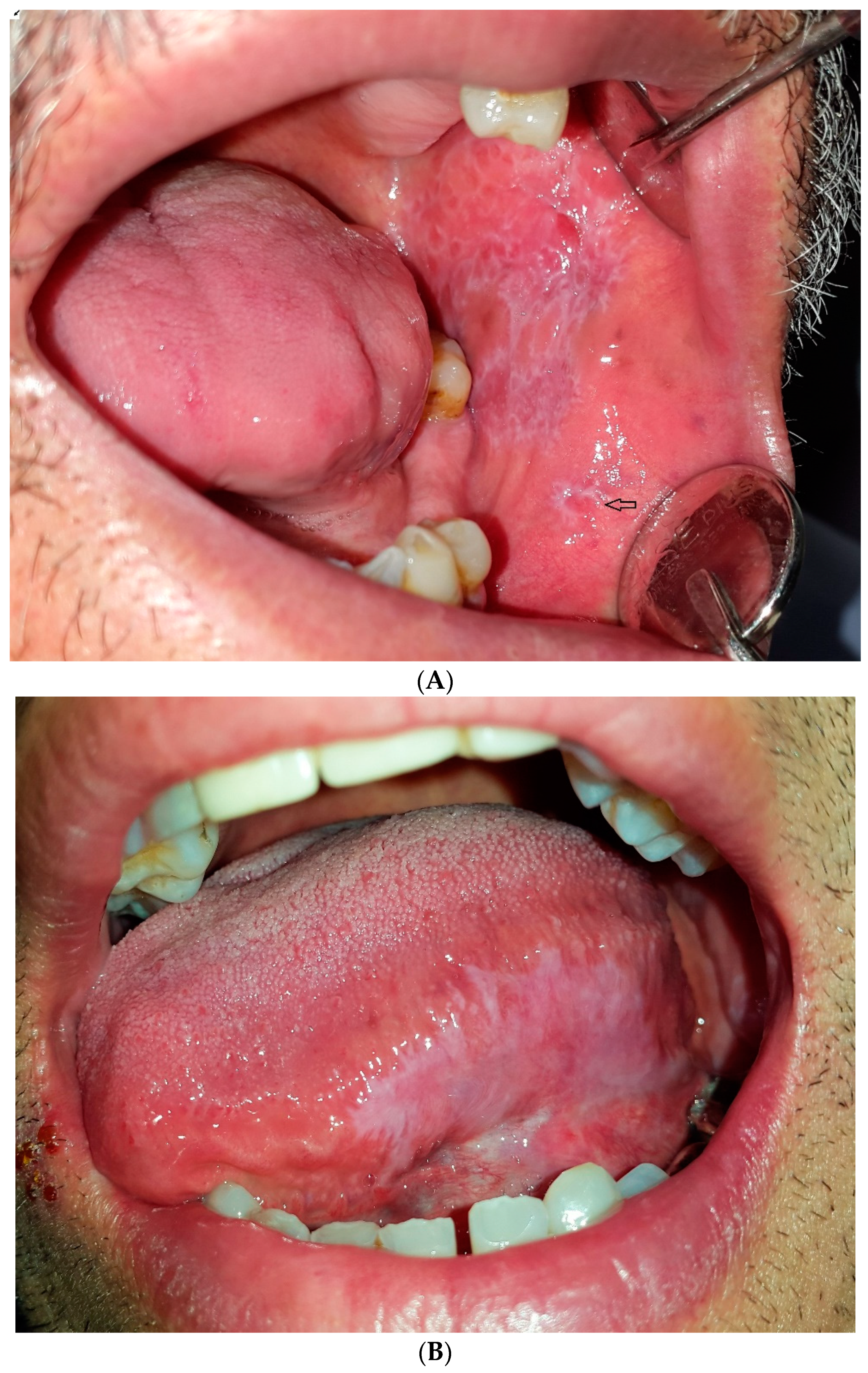 Dentistry 07 00015 g006 Dentistry 07 00015 g006