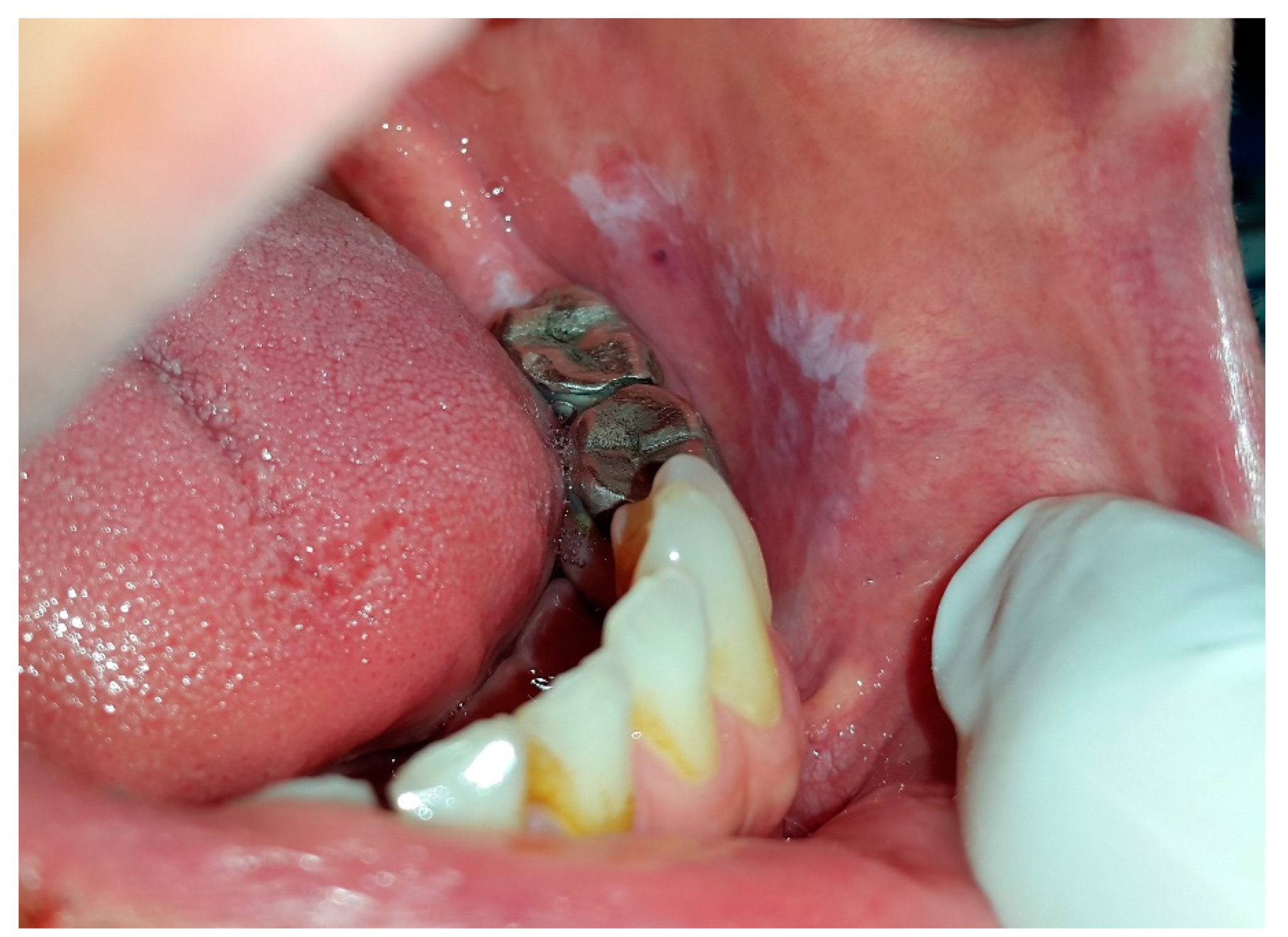 Dentistry 07 00015 g007 Dentistry 07 00015 g007