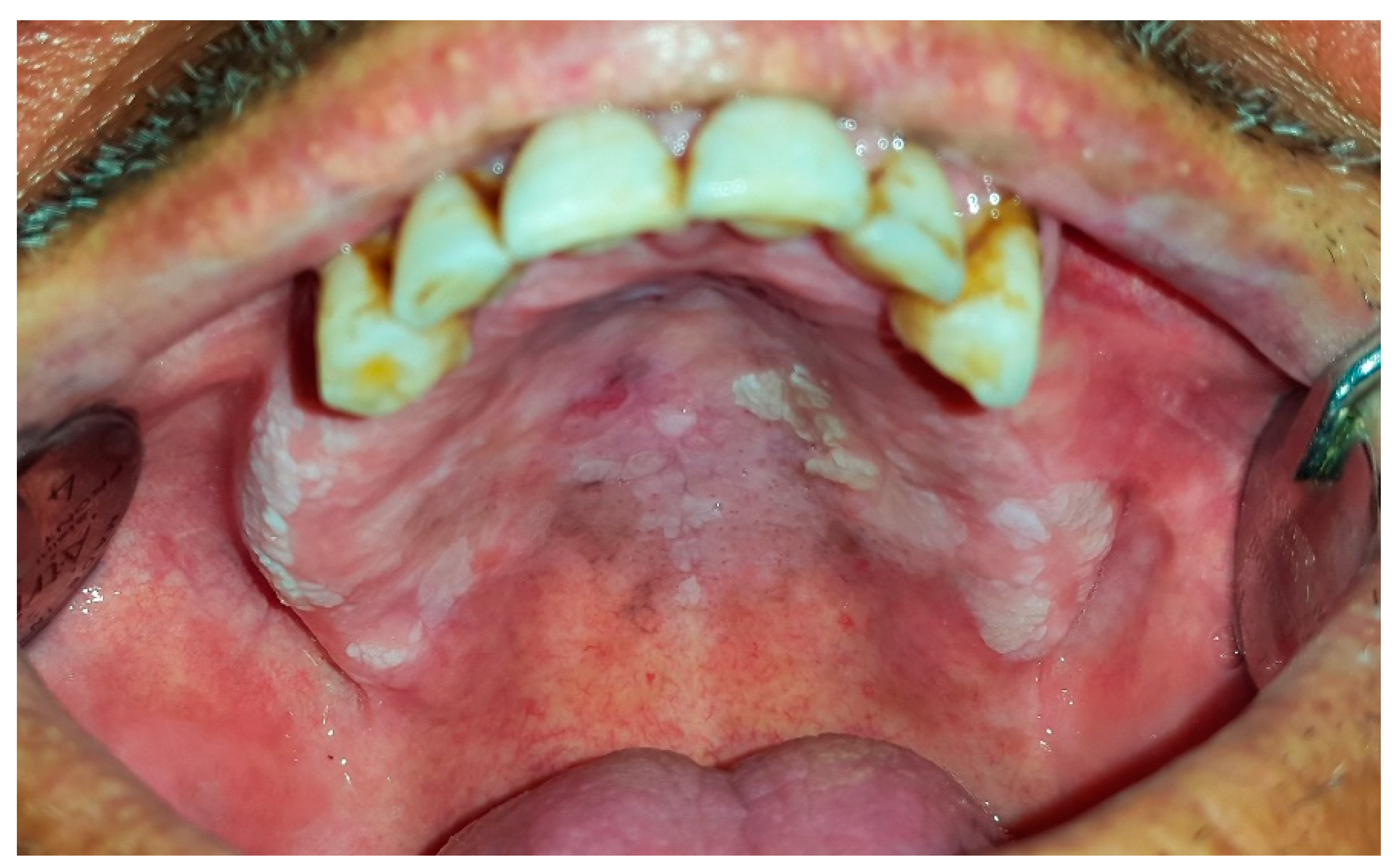 Dentistry 07 00015 g010 Dentistry 07 00015 g010