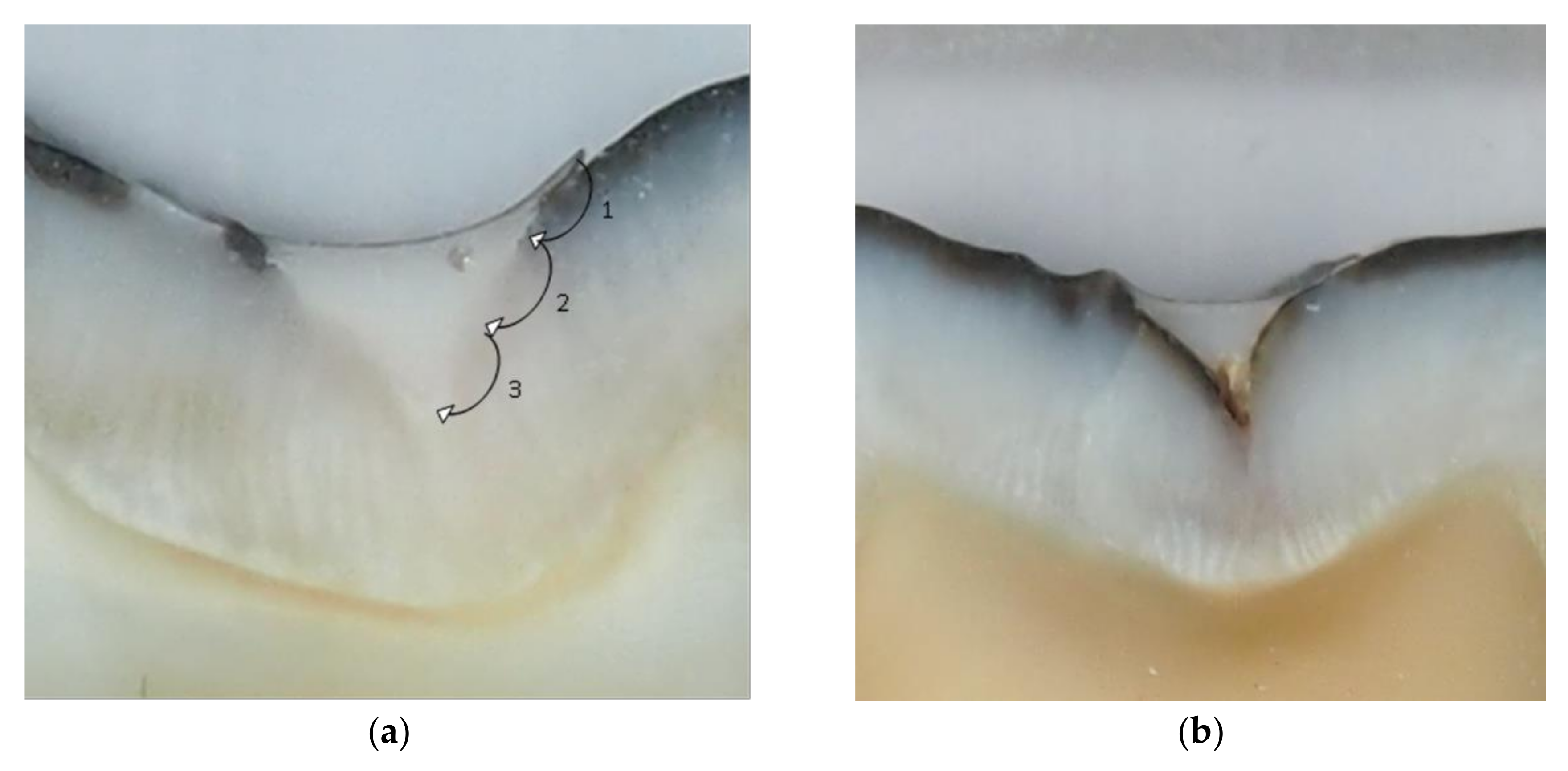 Dentistry 07 00032 g001a