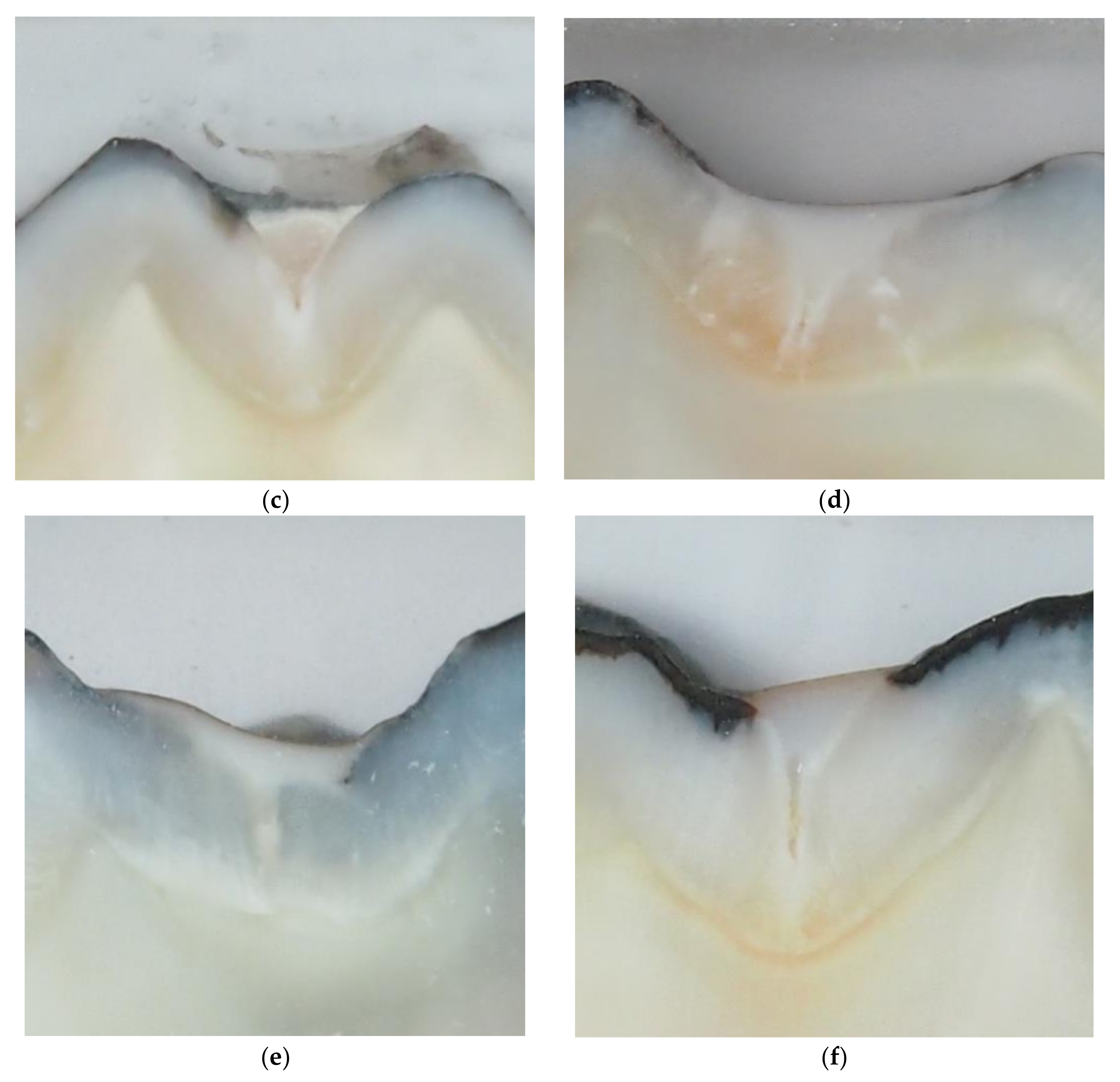 Dentistry 07 00032 g001b