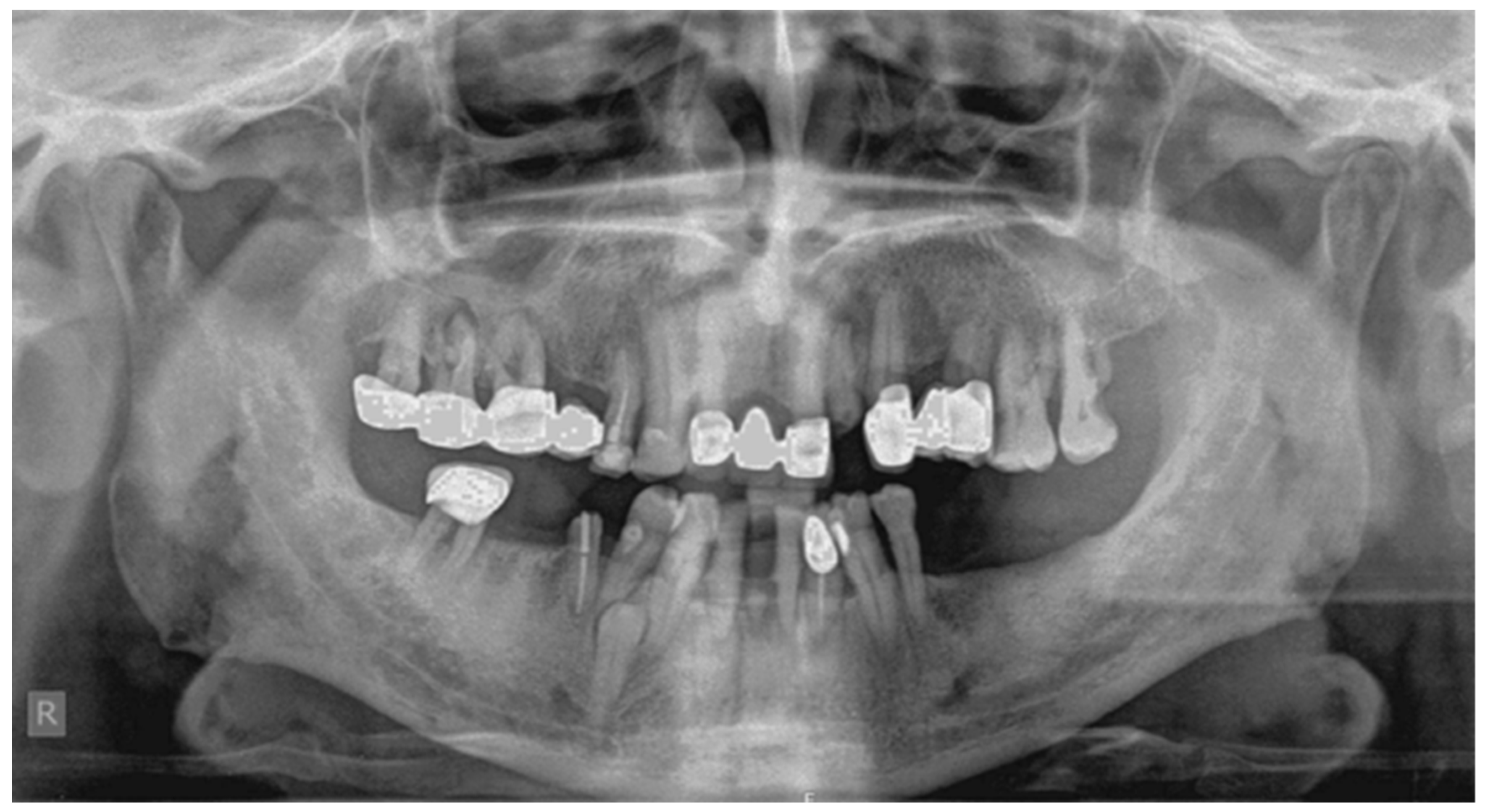 Dentistry 07 00038 g003