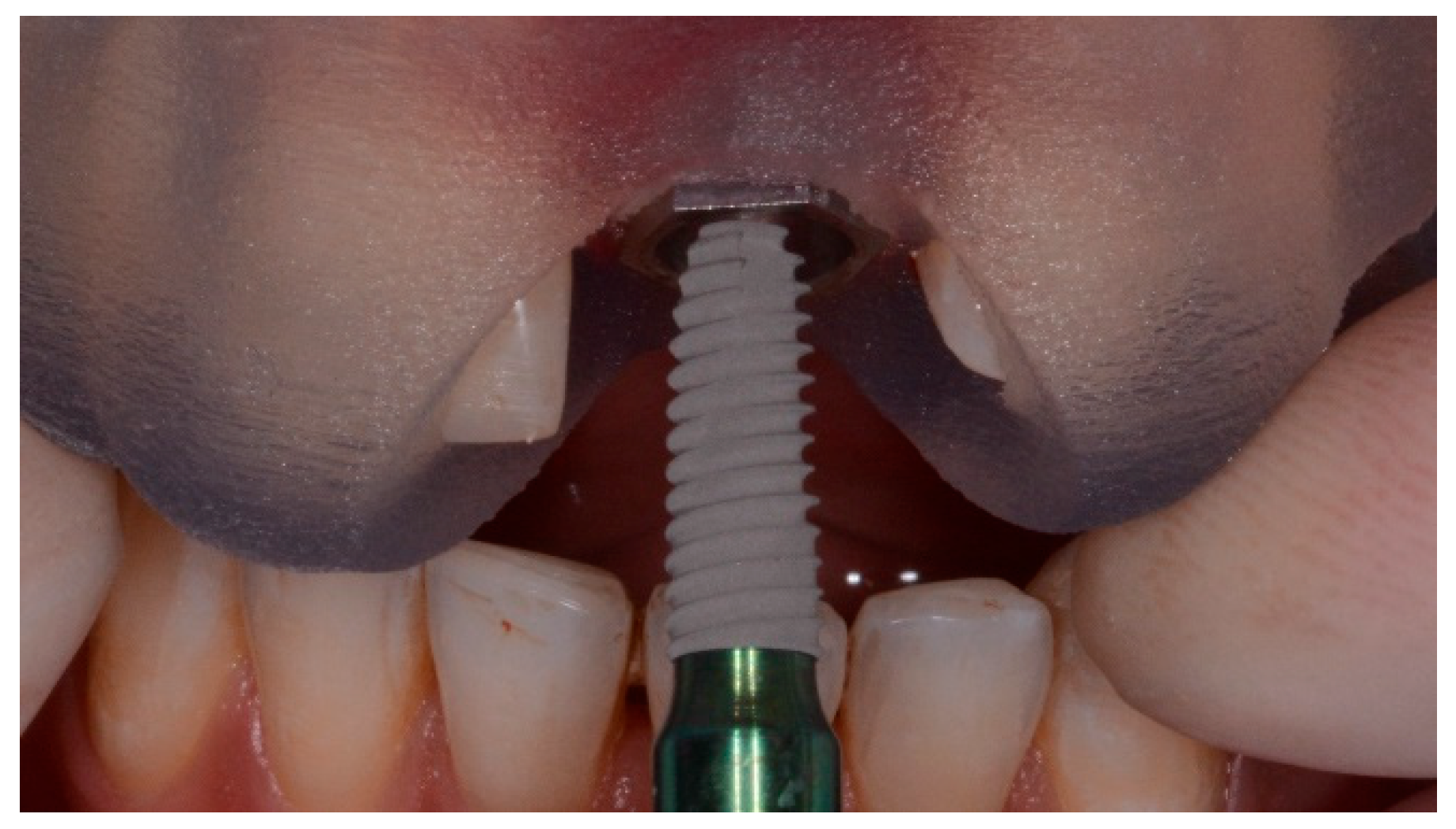 Dentistry 07 00041 g001