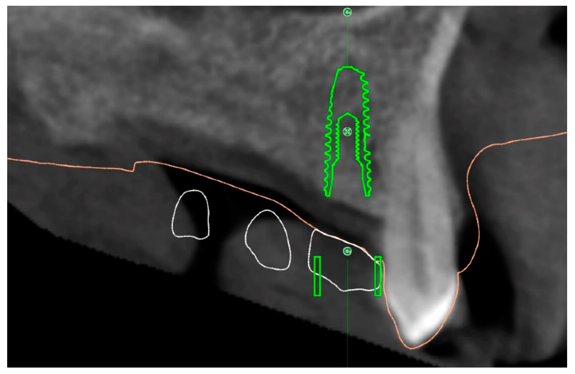 Dentistry 07 00041 g007