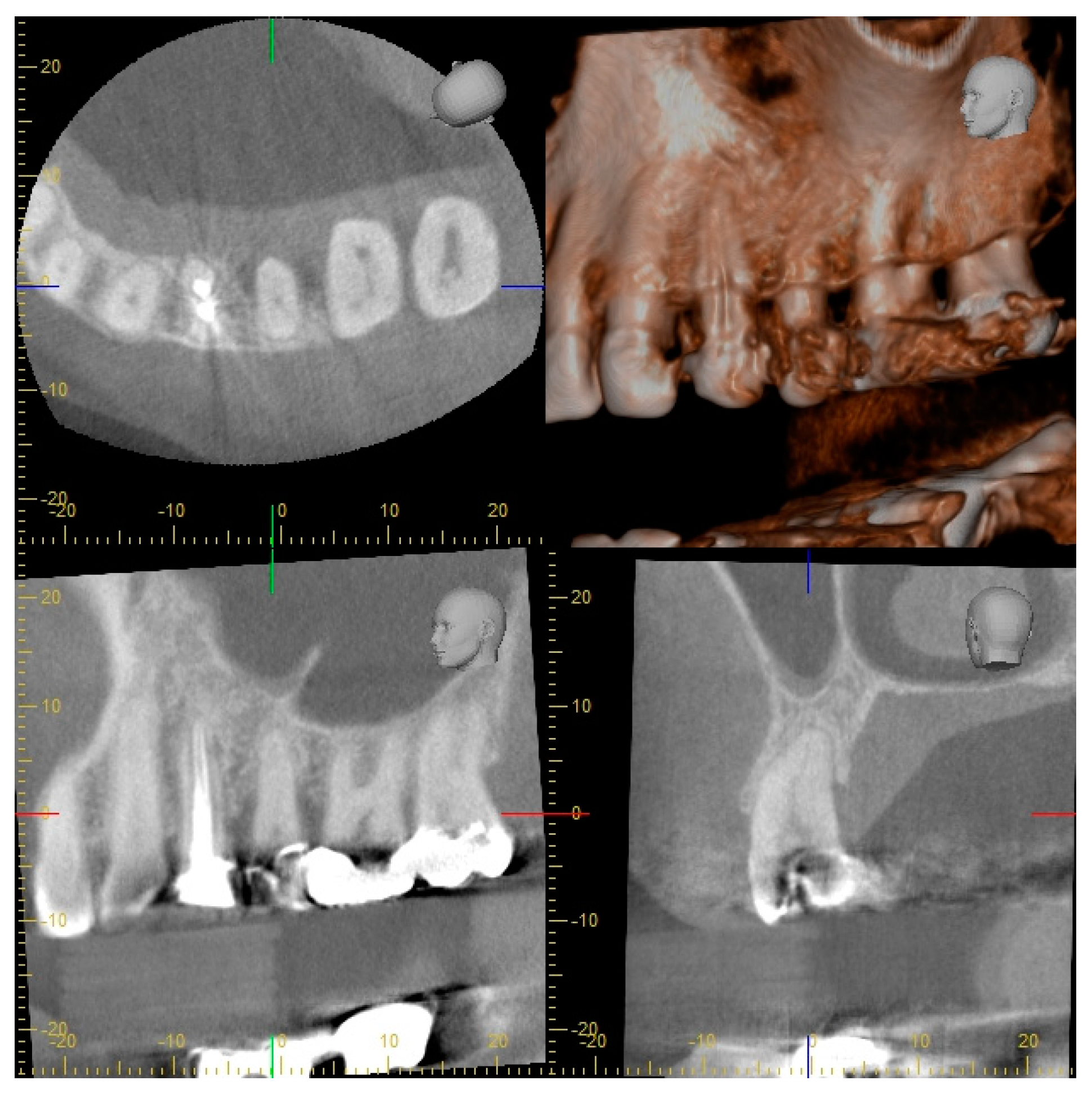 Dentistry 07 00050 g003 Dentistry 07 00050 g003