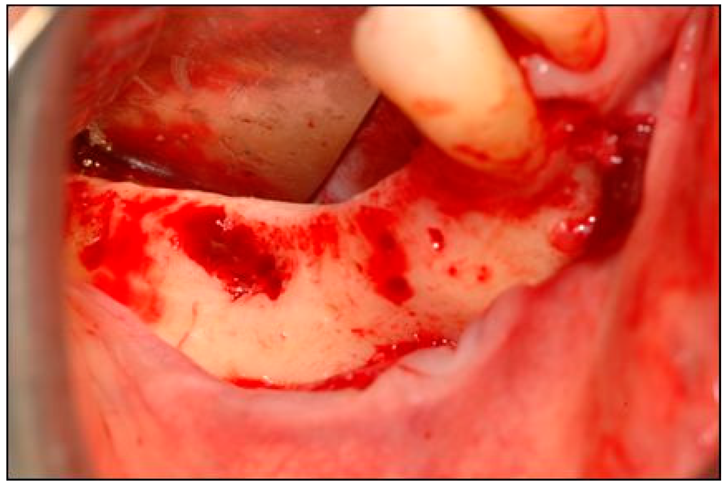 Dentistry 07 00077 g004