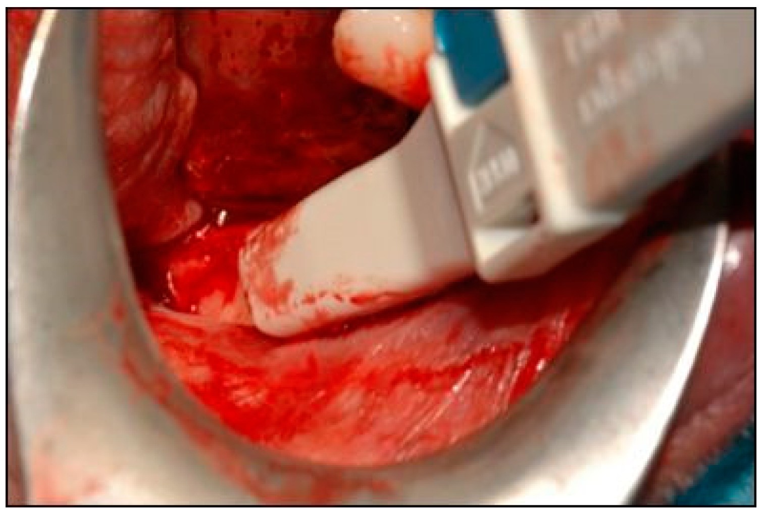 Dentistry 07 00077 g005