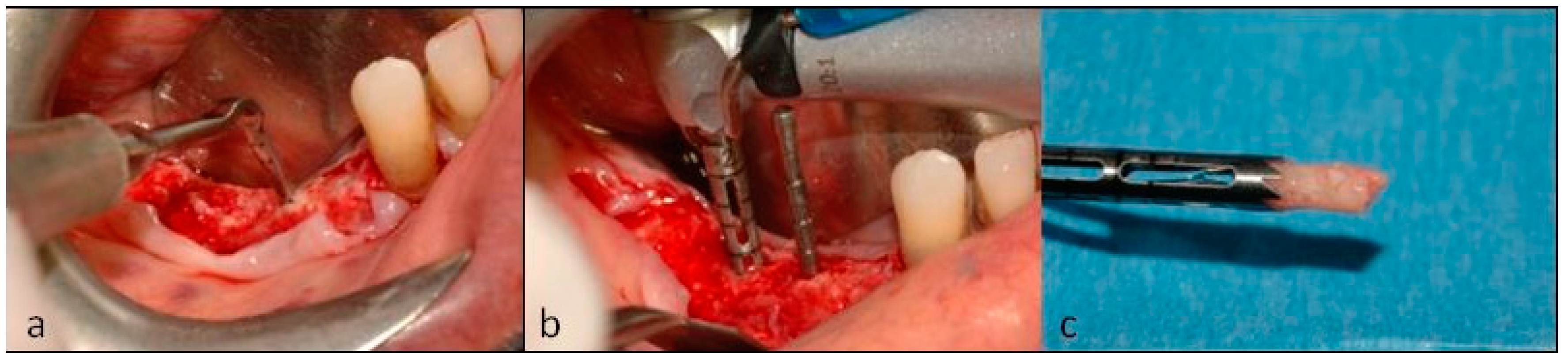 Dentistry 07 00077 g010