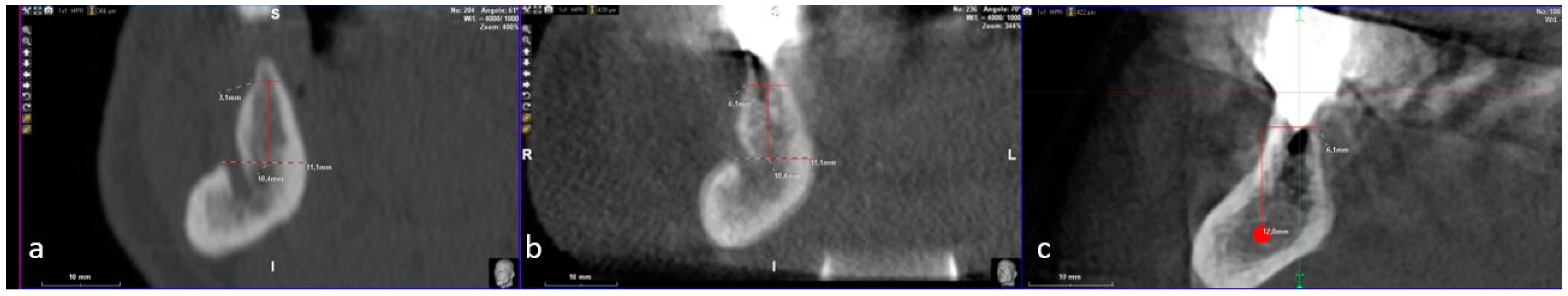 Dentistry 07 00077 g013