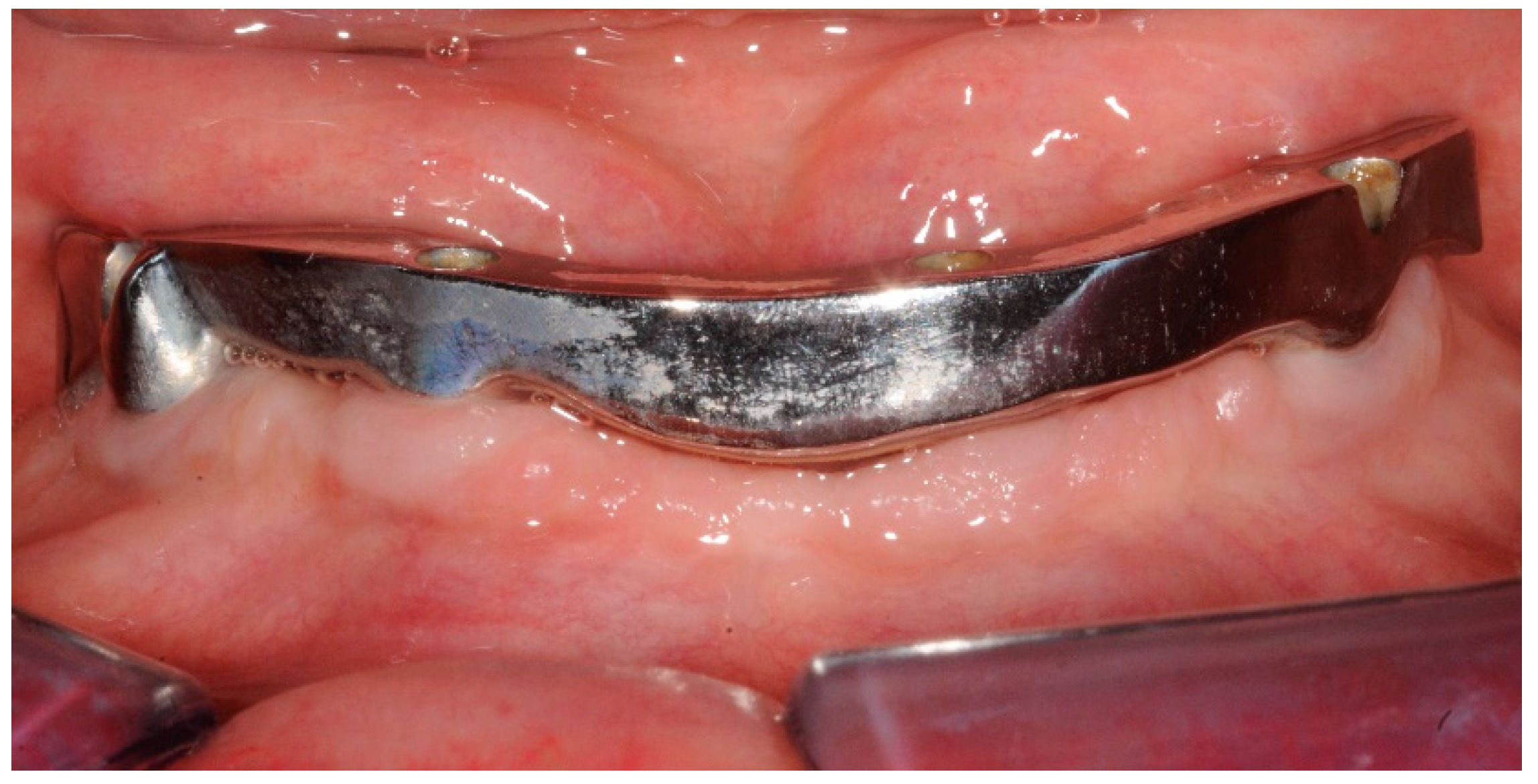 Dentistry 07 00084 g002 Dentistry 07 00084 g002