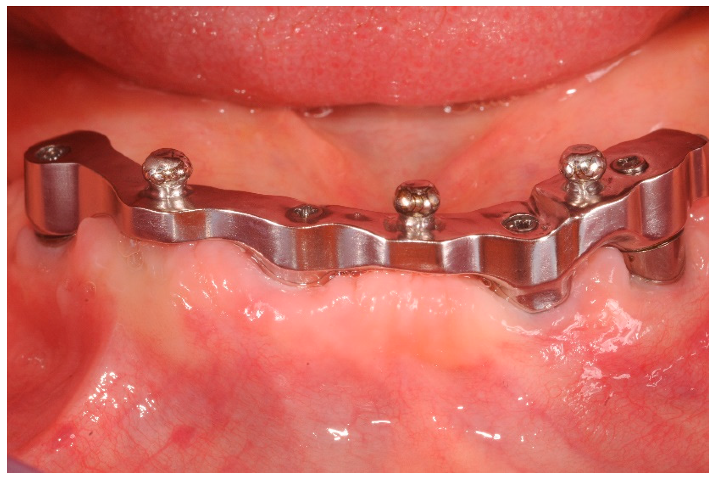 Dentistry 07 00084 g003 Dentistry 07 00084 g003