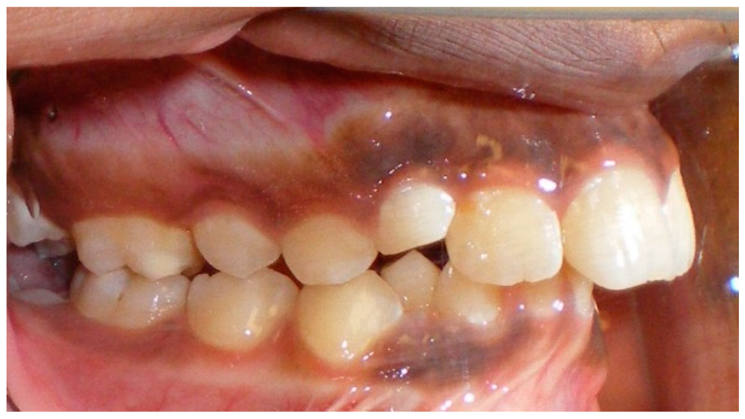 Dentistry 07 00089 g011