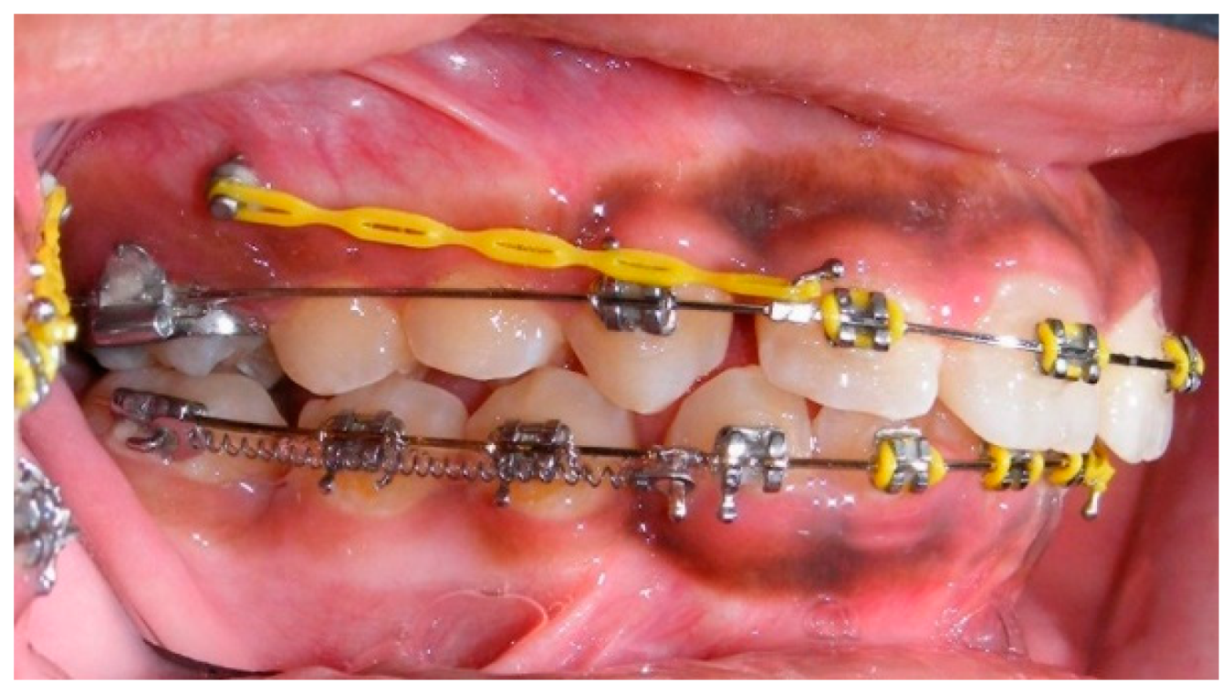 Dentistry 07 00089 g013