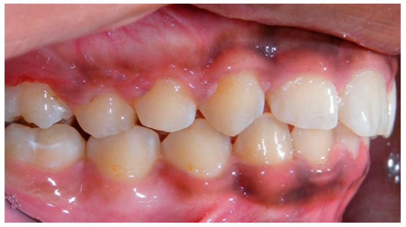 Dentistry 07 00089 g014