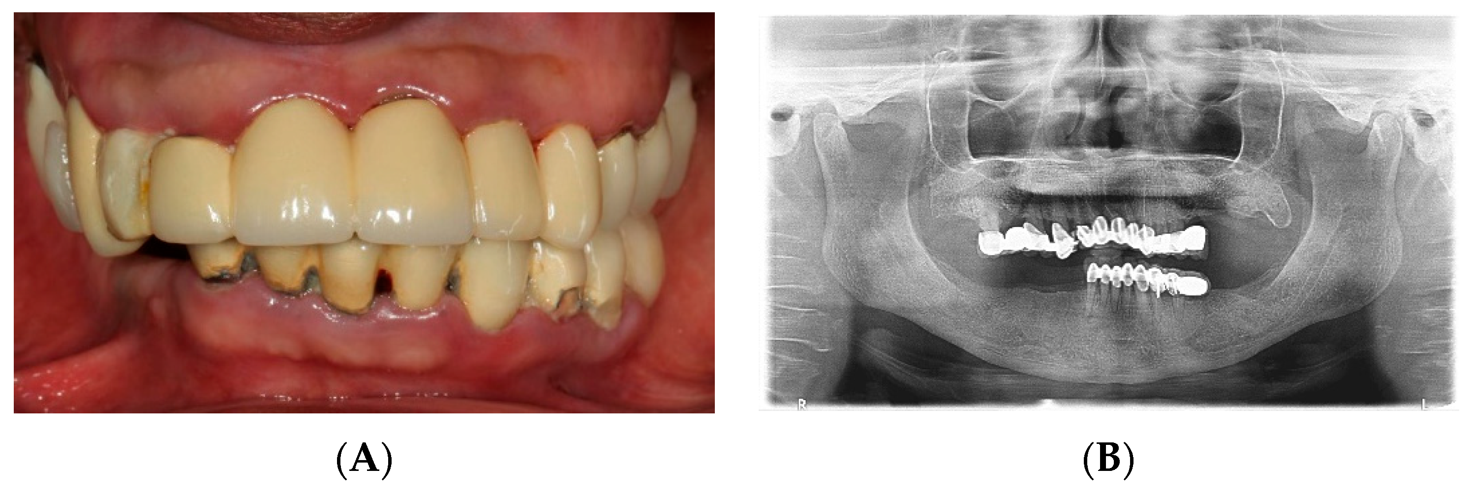 Dentistry 07 00100 g001