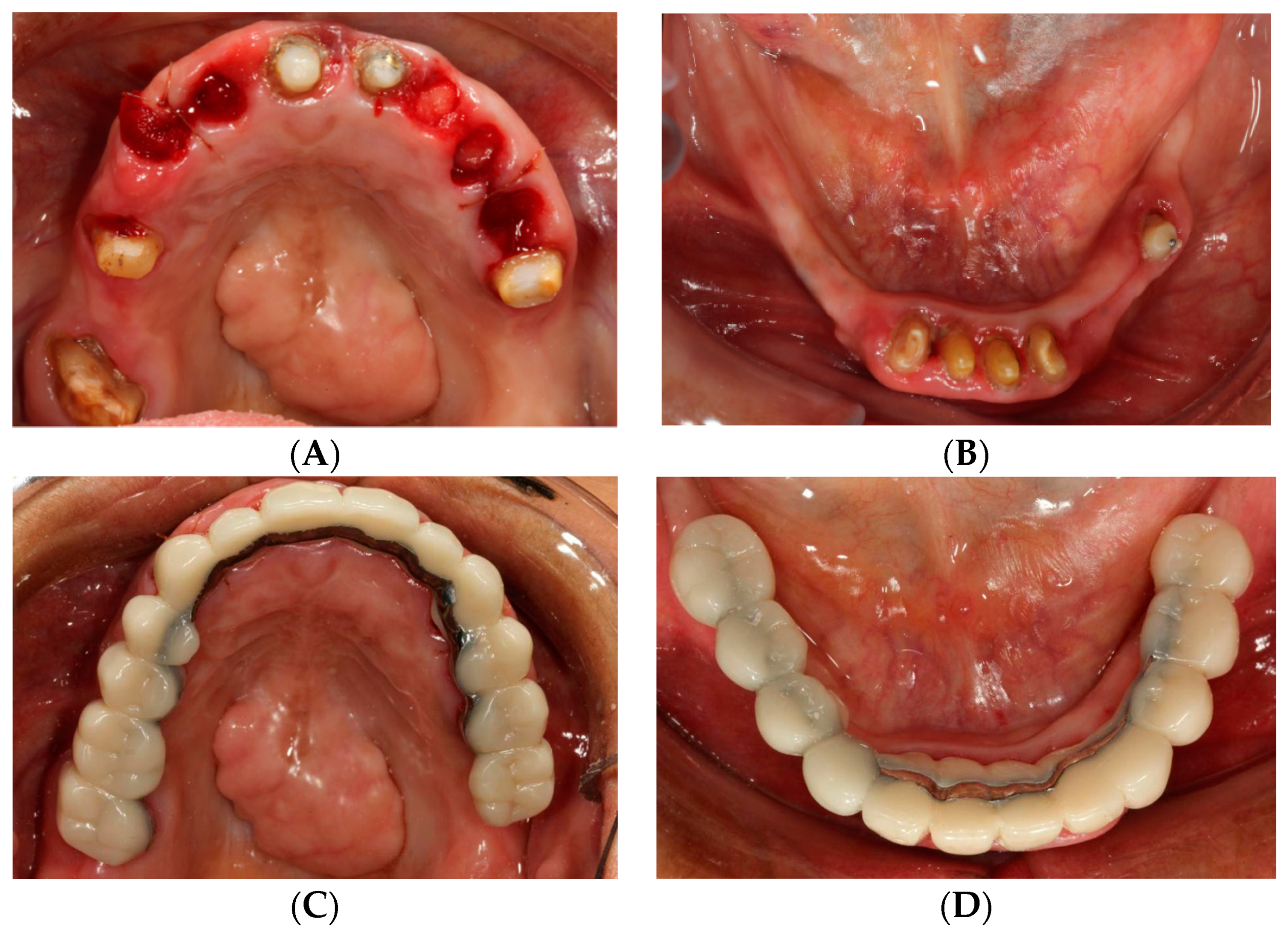 Dentistry 07 00100 g002