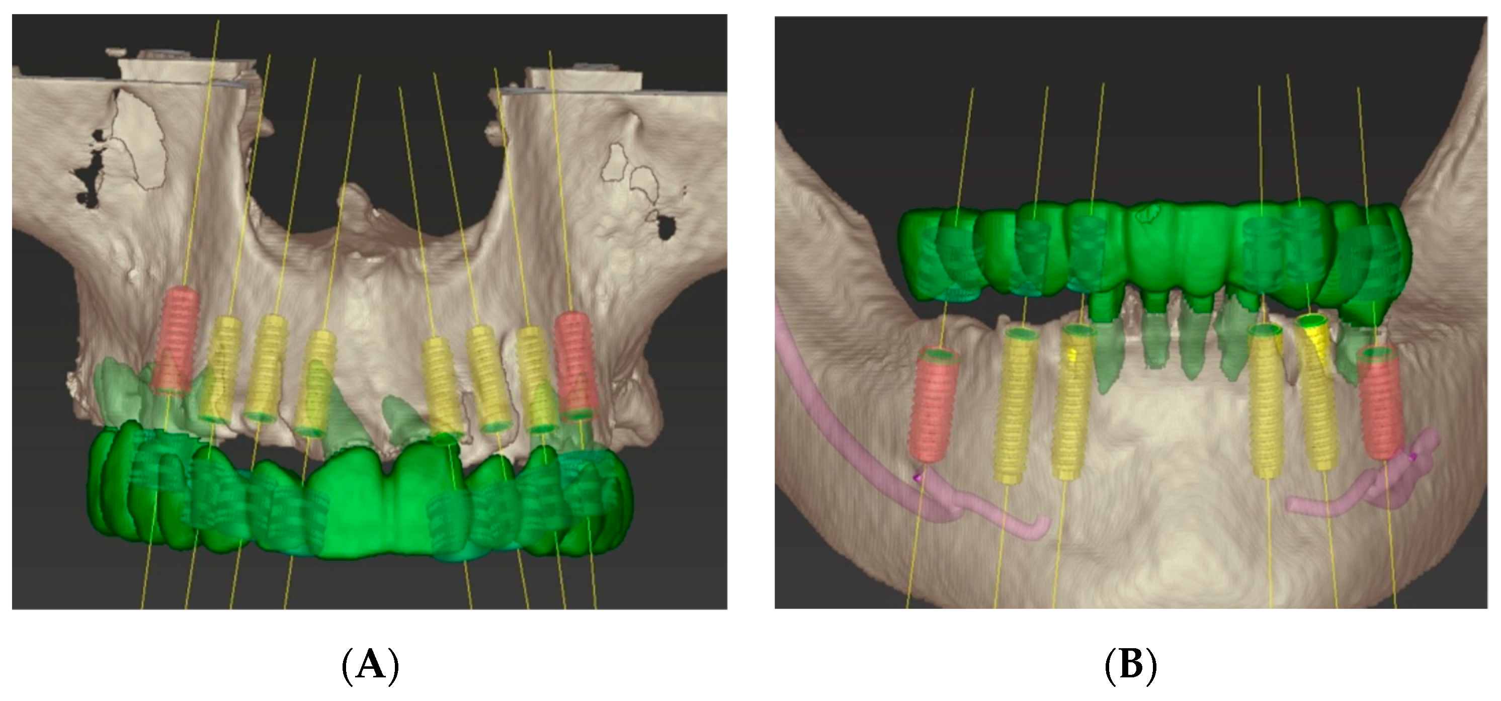 Dentistry 07 00100 g003