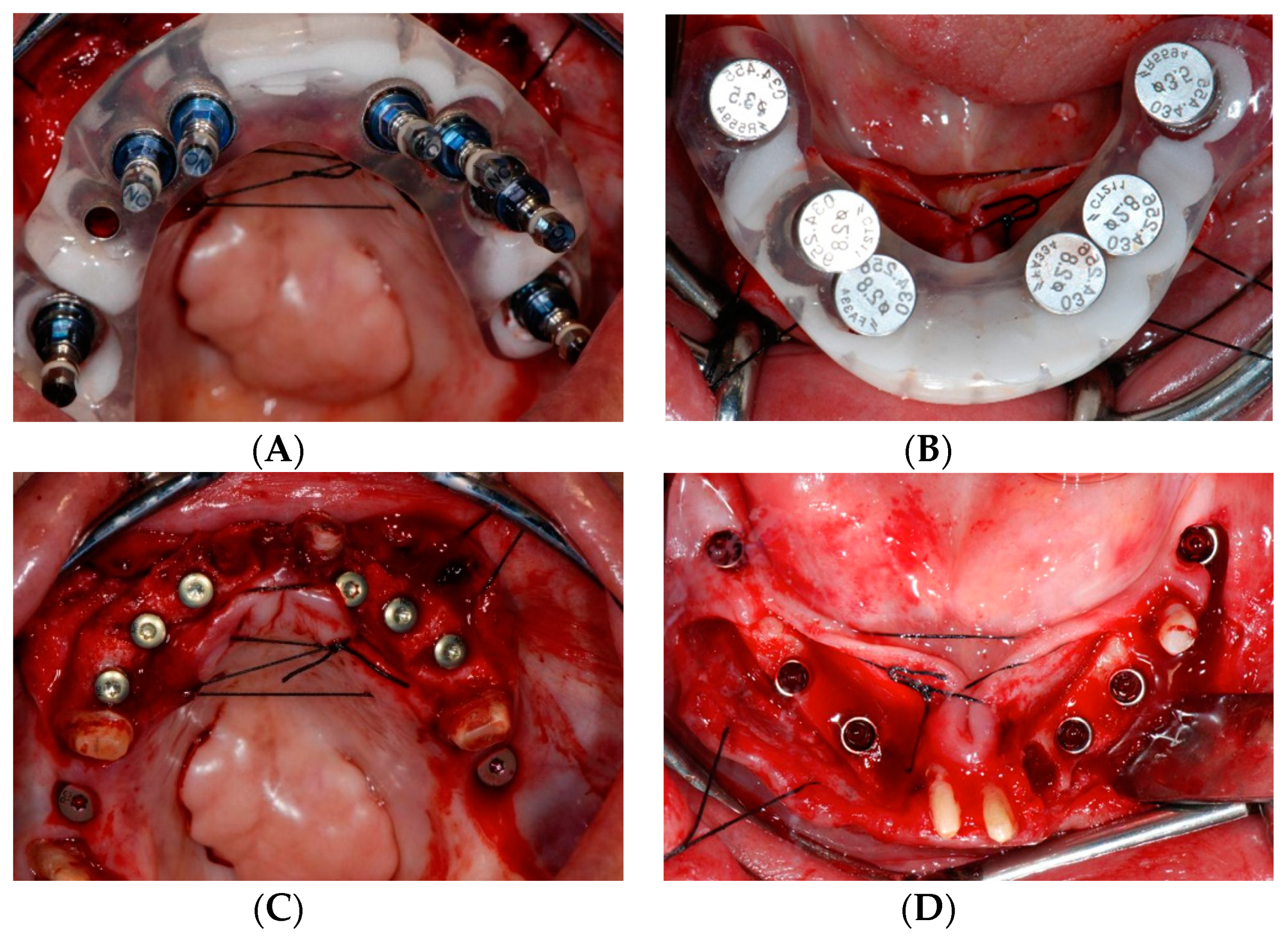 Dentistry 07 00100 g004