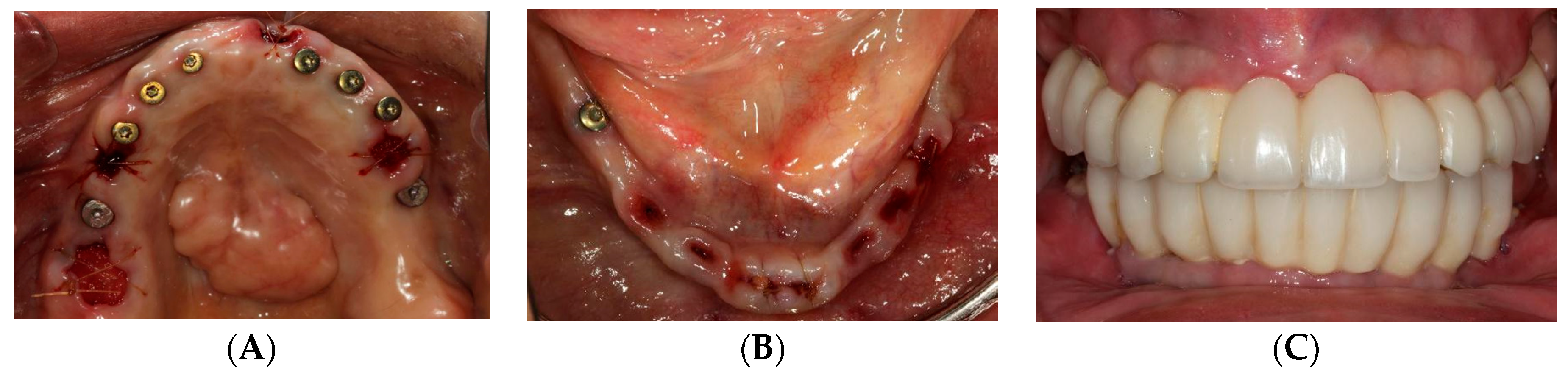 Dentistry 07 00100 g005