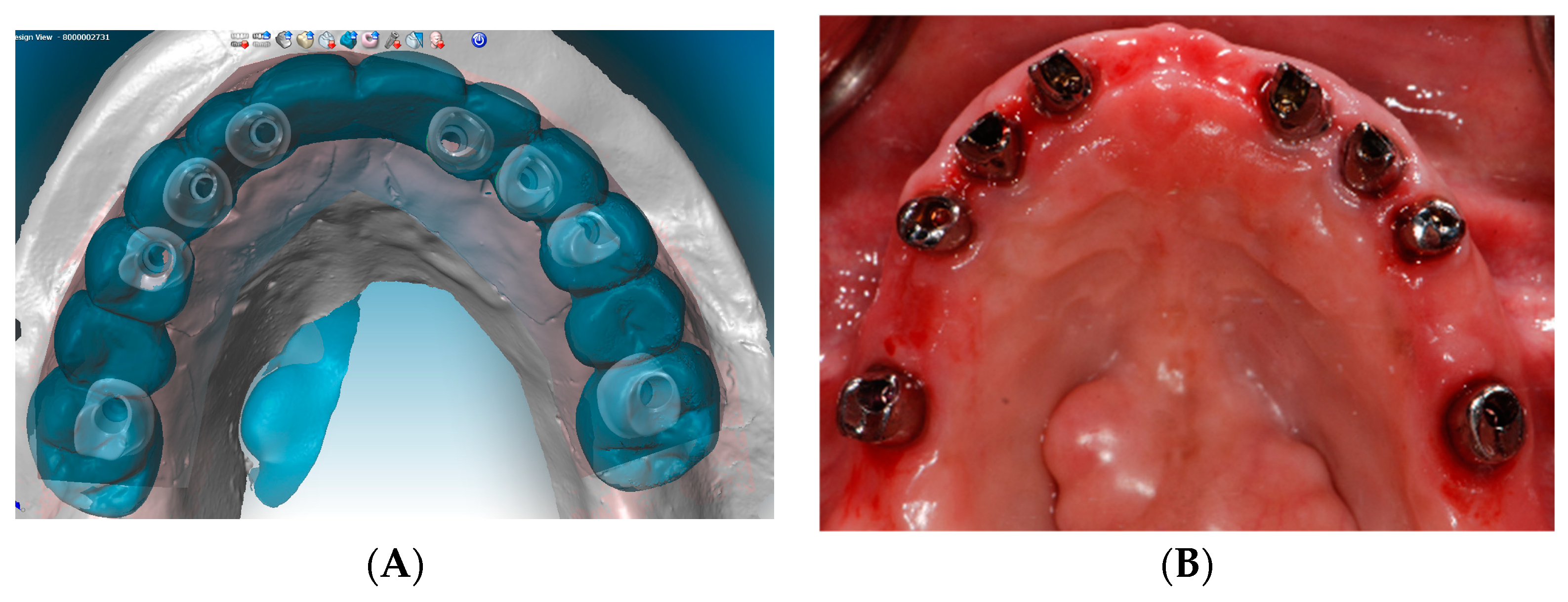 Dentistry 07 00100 g006a