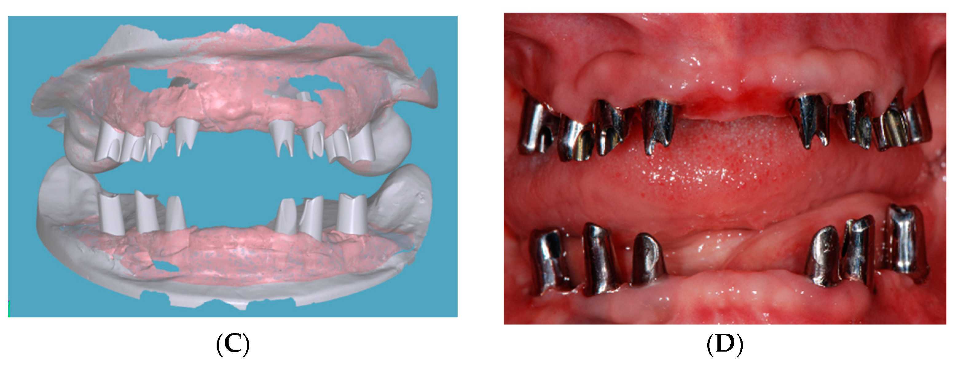 Dentistry 07 00100 g006b