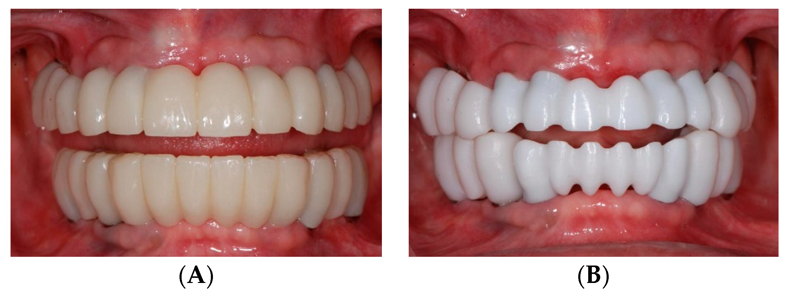 Dentistry 07 00100 g007