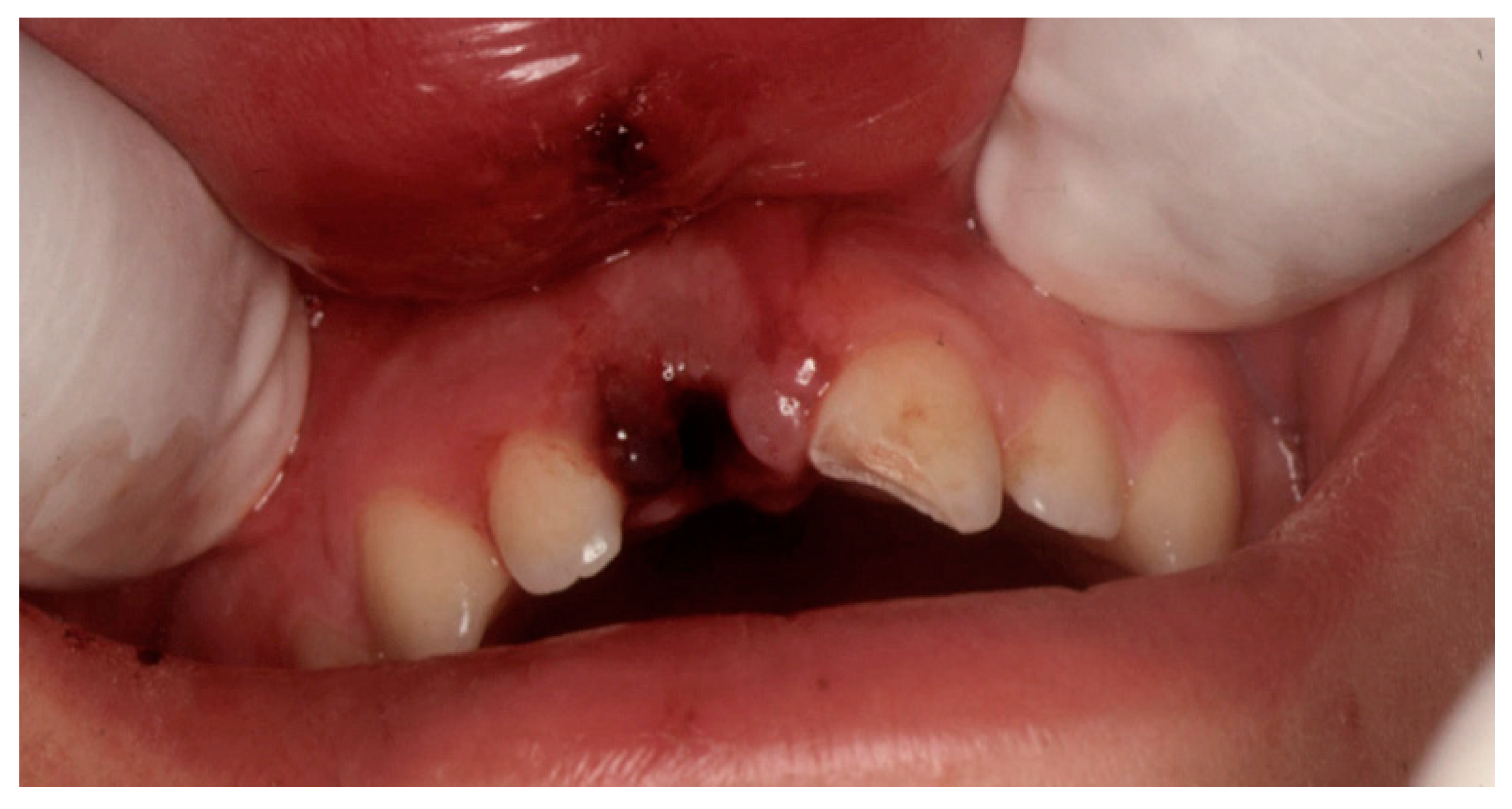Dentistry 07 00101 g001 Dentistry 07 00101 g001
