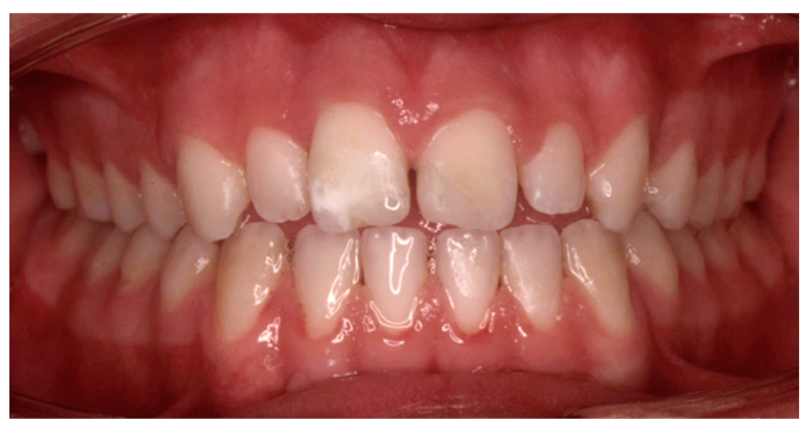 Dentistry 07 00101 g004 Dentistry 07 00101 g004