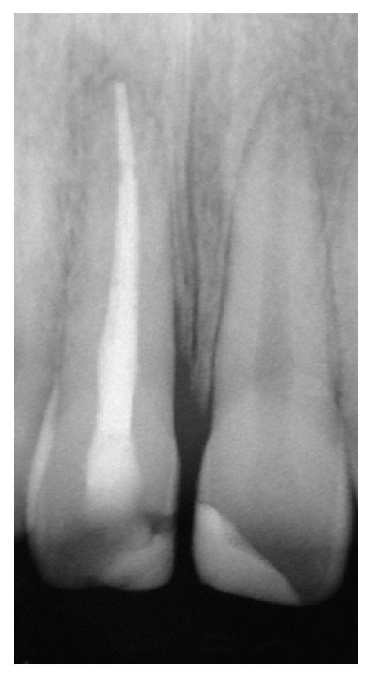 Dentistry 07 00101 g005 Dentistry 07 00101 g005