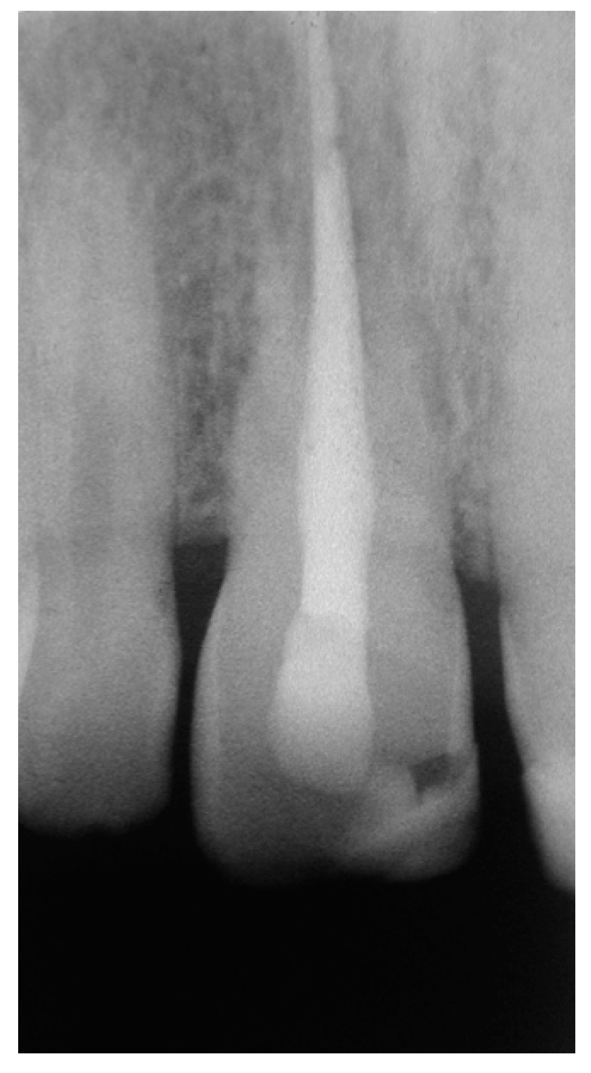 Dentistry 07 00101 g006 Dentistry 07 00101 g006