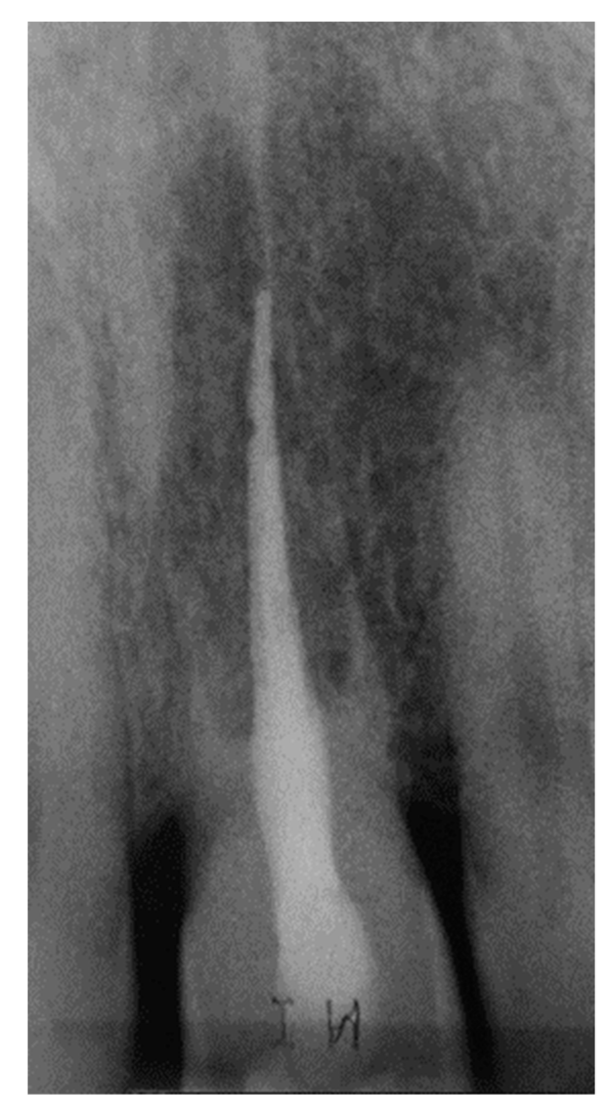 Dentistry 07 00101 g007 Dentistry 07 00101 g007